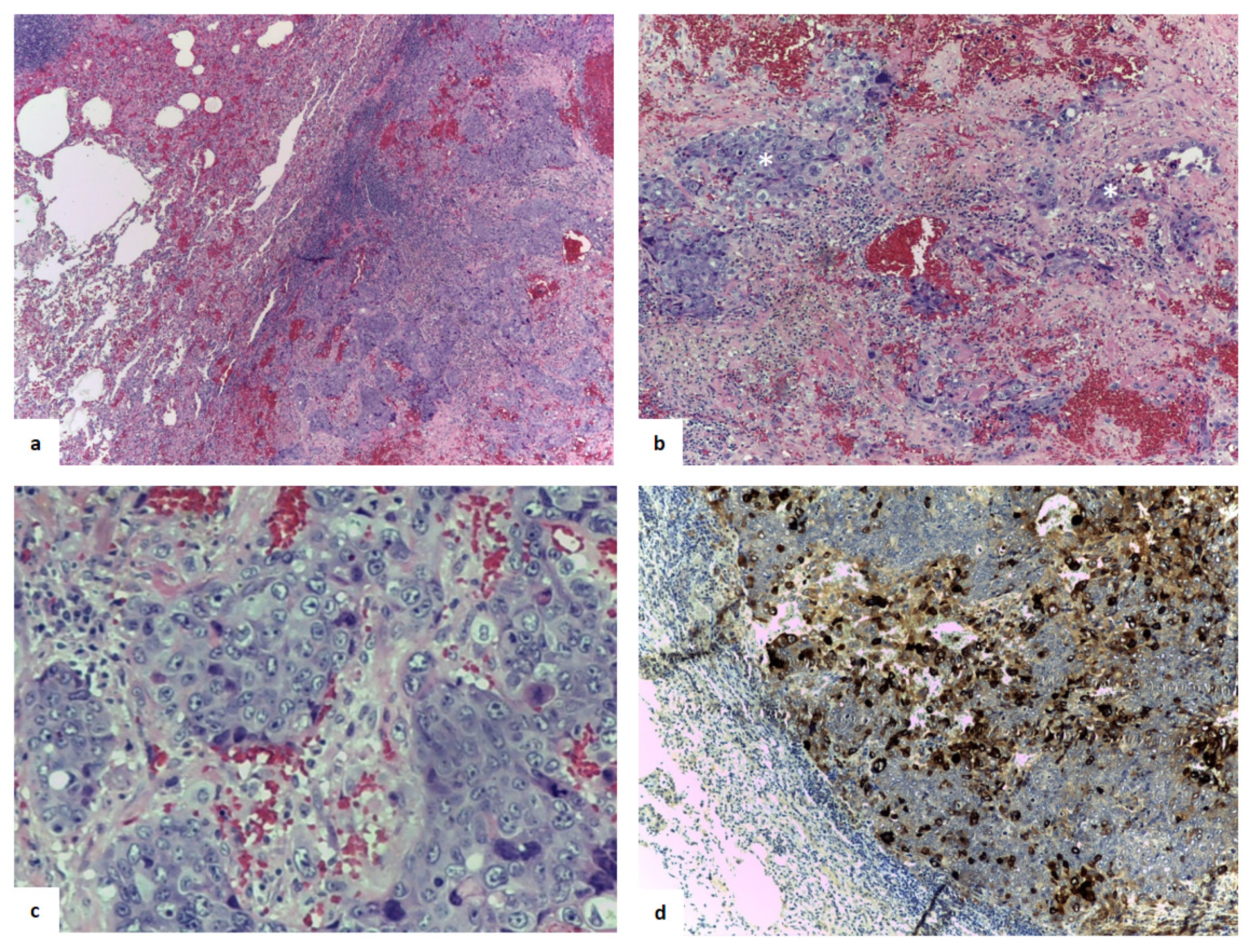 JCM | Free Full-Text | When a Differential Diagnosis Is Fundamental