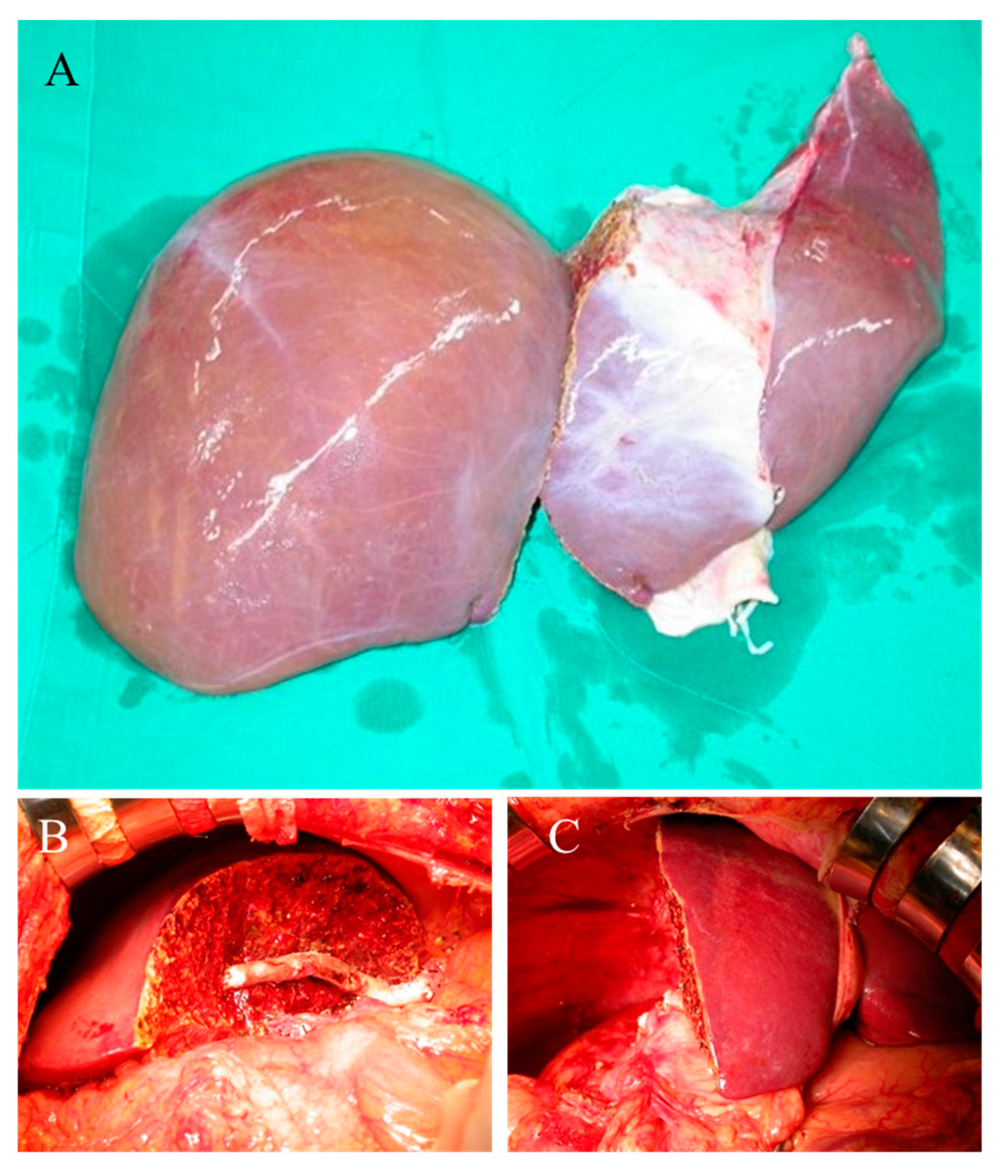 Jcm 08 02095 g001 Jcm 08 02095 g001