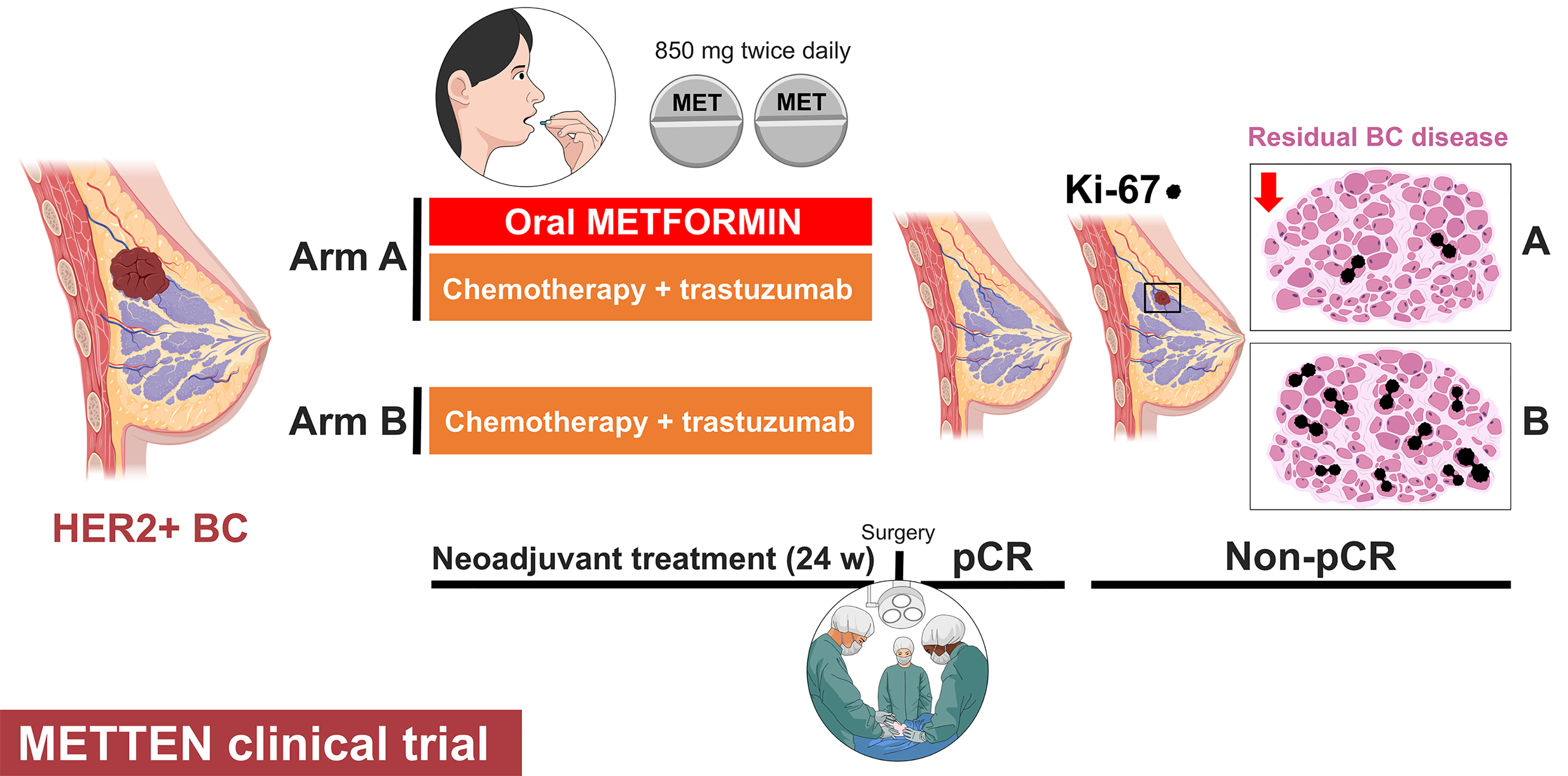 JCM | Free Full-Text | Neoadjuvant Metformin Added Systemic Therapy Decreases the Proliferative Capacity of Residual Breast Cancer |
