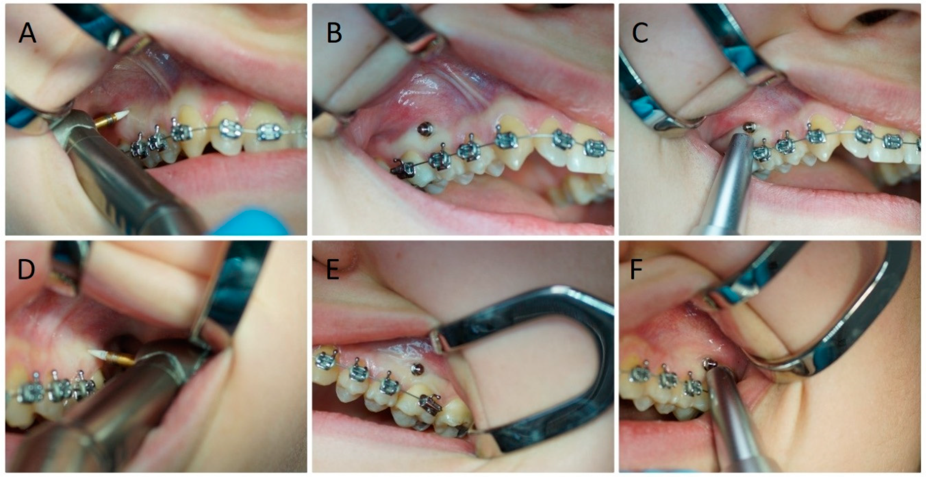 Jcm 09 00112 g002 Jcm 09 00112 g002