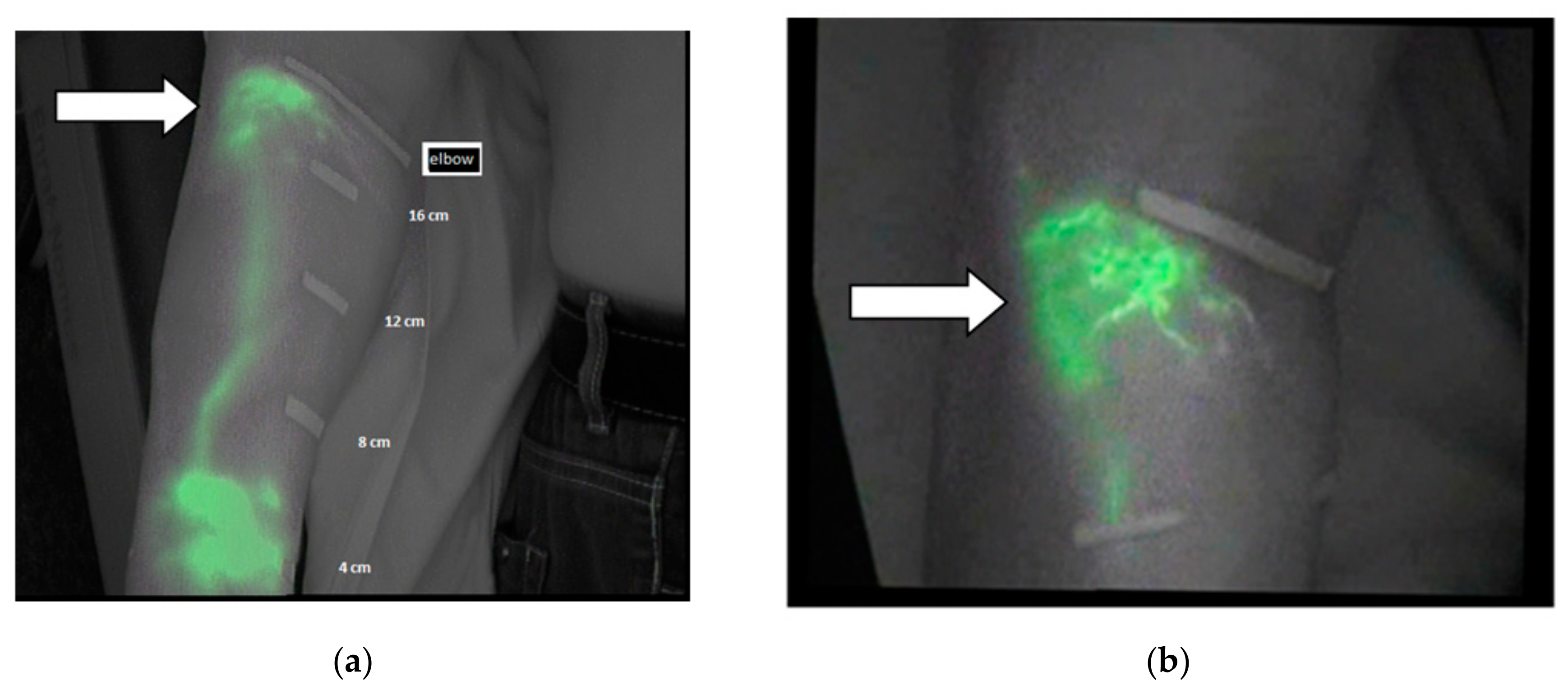 Jcm 09 00306 g003 Jcm 09 00306 g003