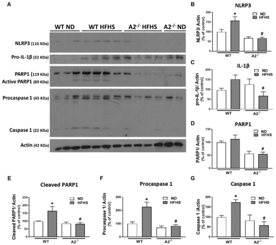 Role of Arginase 2 in Murine Retinopathy Associated with Western