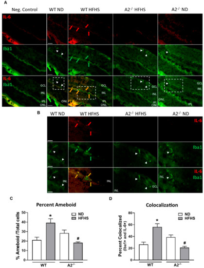 Role of Arginase 2 in Murine Retinopathy Associated with Western