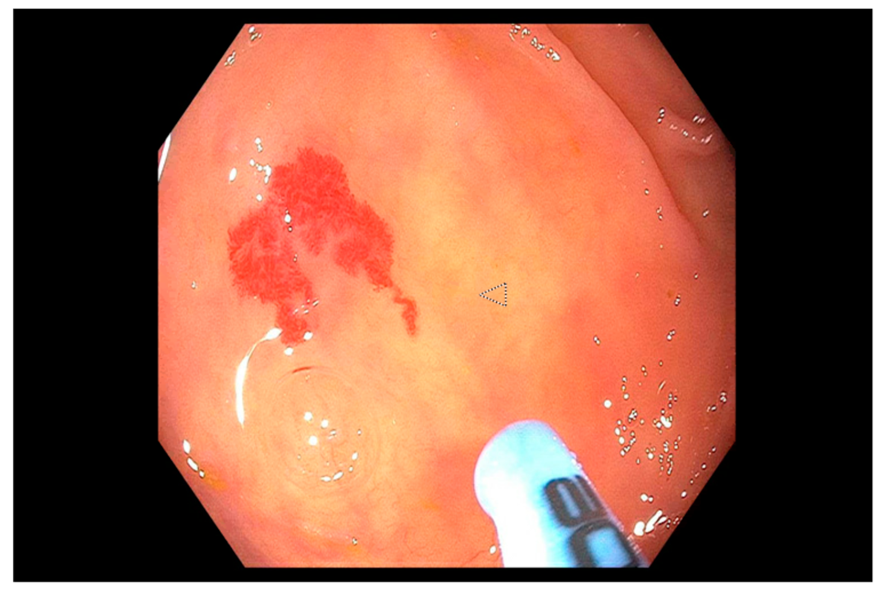 Jcm 09 00402 g007 Jcm 09 00402 g007