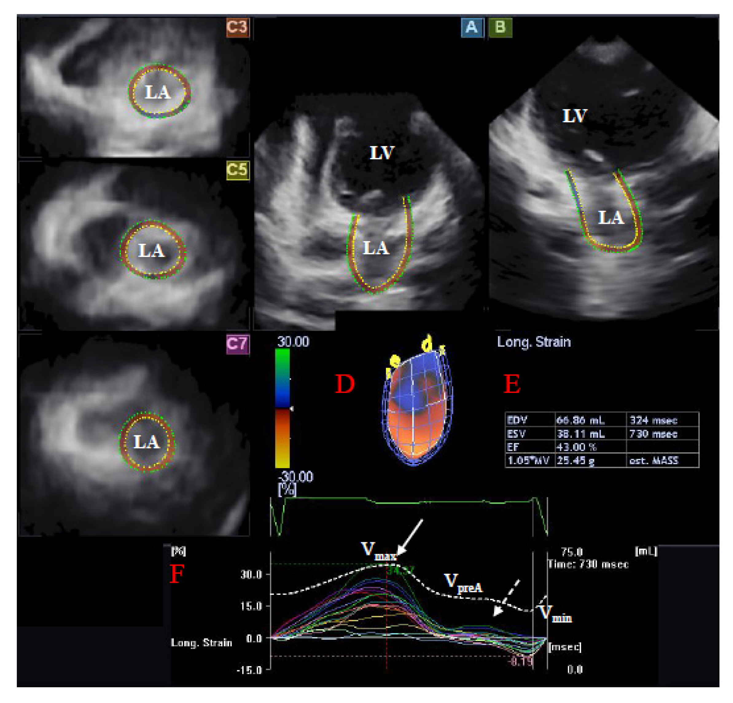 Two-dimensional speckle tracking echocardiography for the assessment of  atrial function