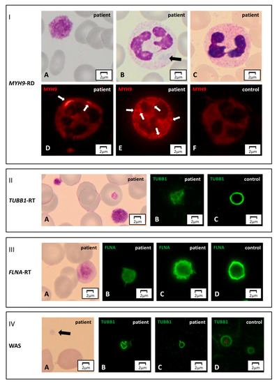 JCM | Free Full-Text | Diagnosis of Inherited Platelet Disorders on a