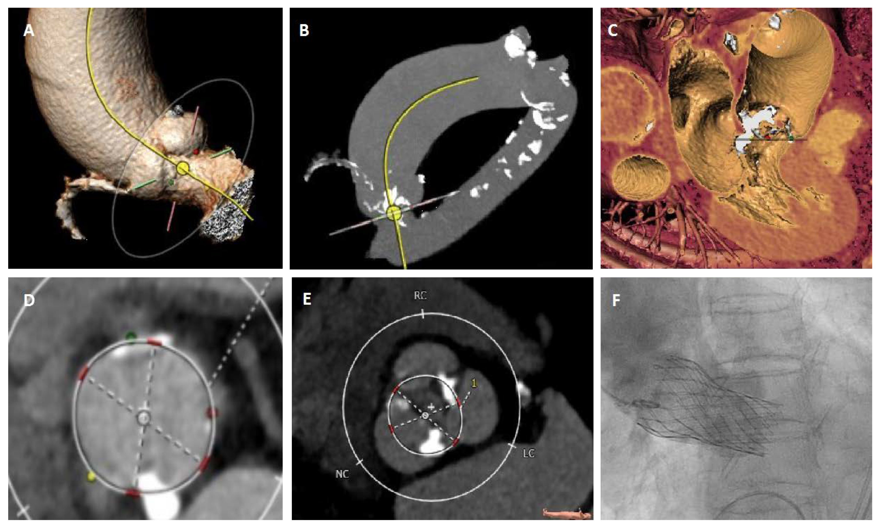 Jcm 09 00662 g003 Jcm 09 00662 g003