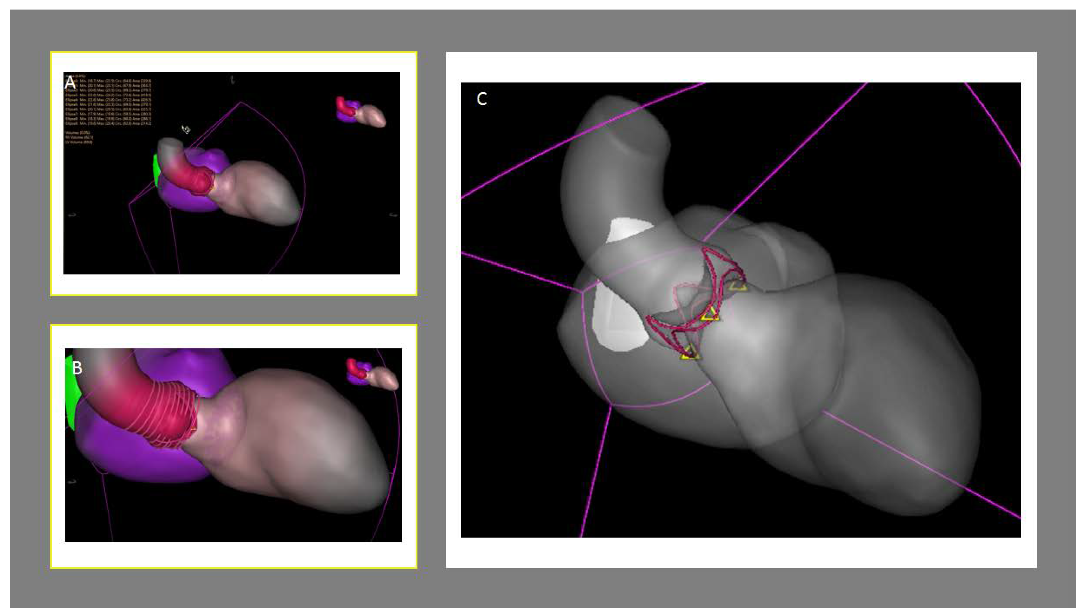 Jcm 09 00662 g004 Jcm 09 00662 g004