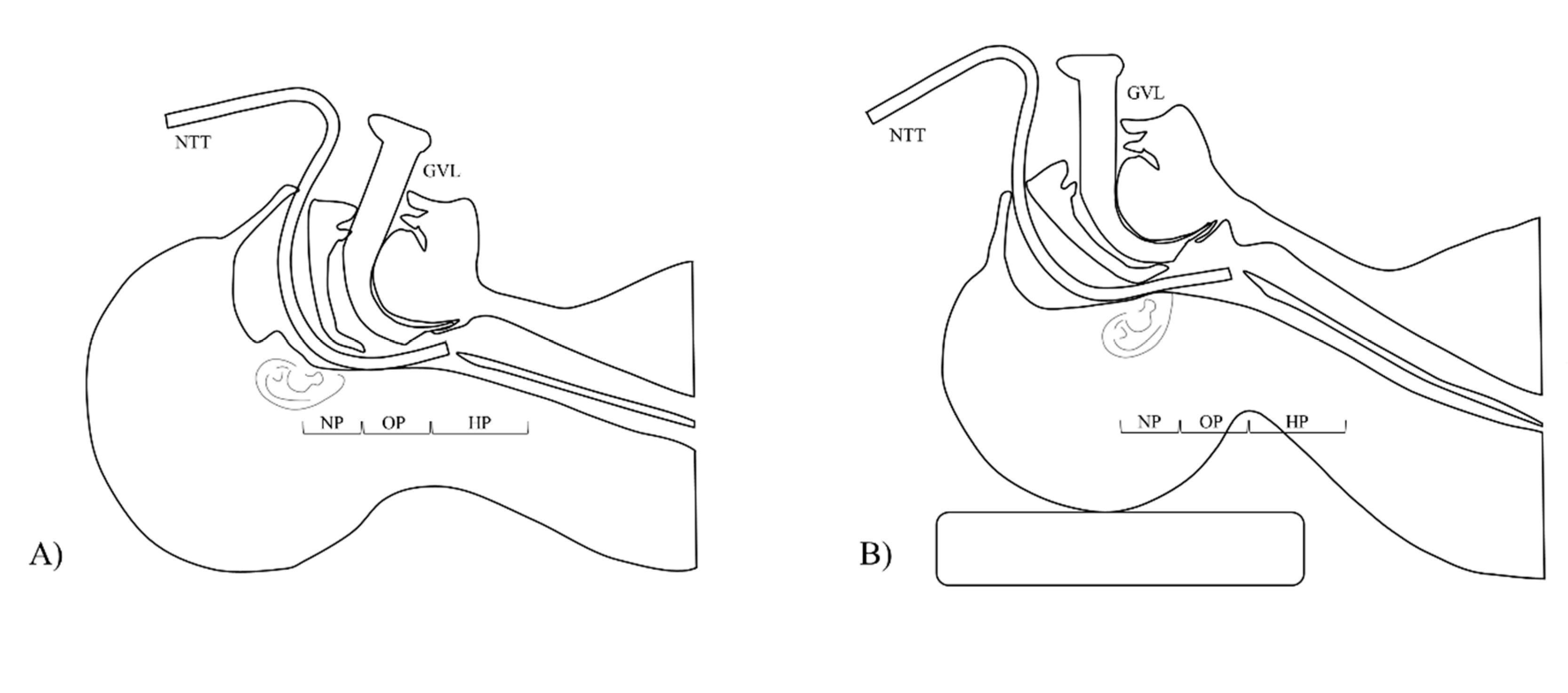 JCM Free FullText Neutral Position Facilitates Nasotracheal