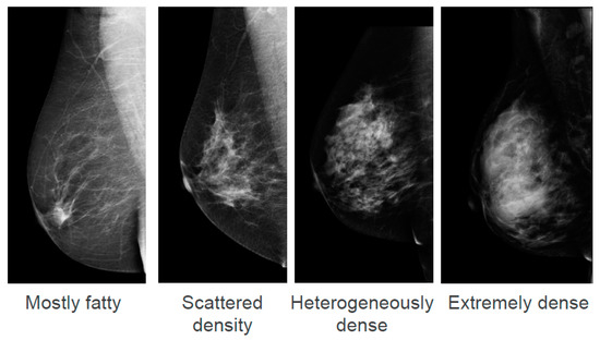 Jcm Free Full Text Breast Density Notification An Australian Perspective Html Jcm Free Full Text Breast Density Notification An Australian Perspective Html