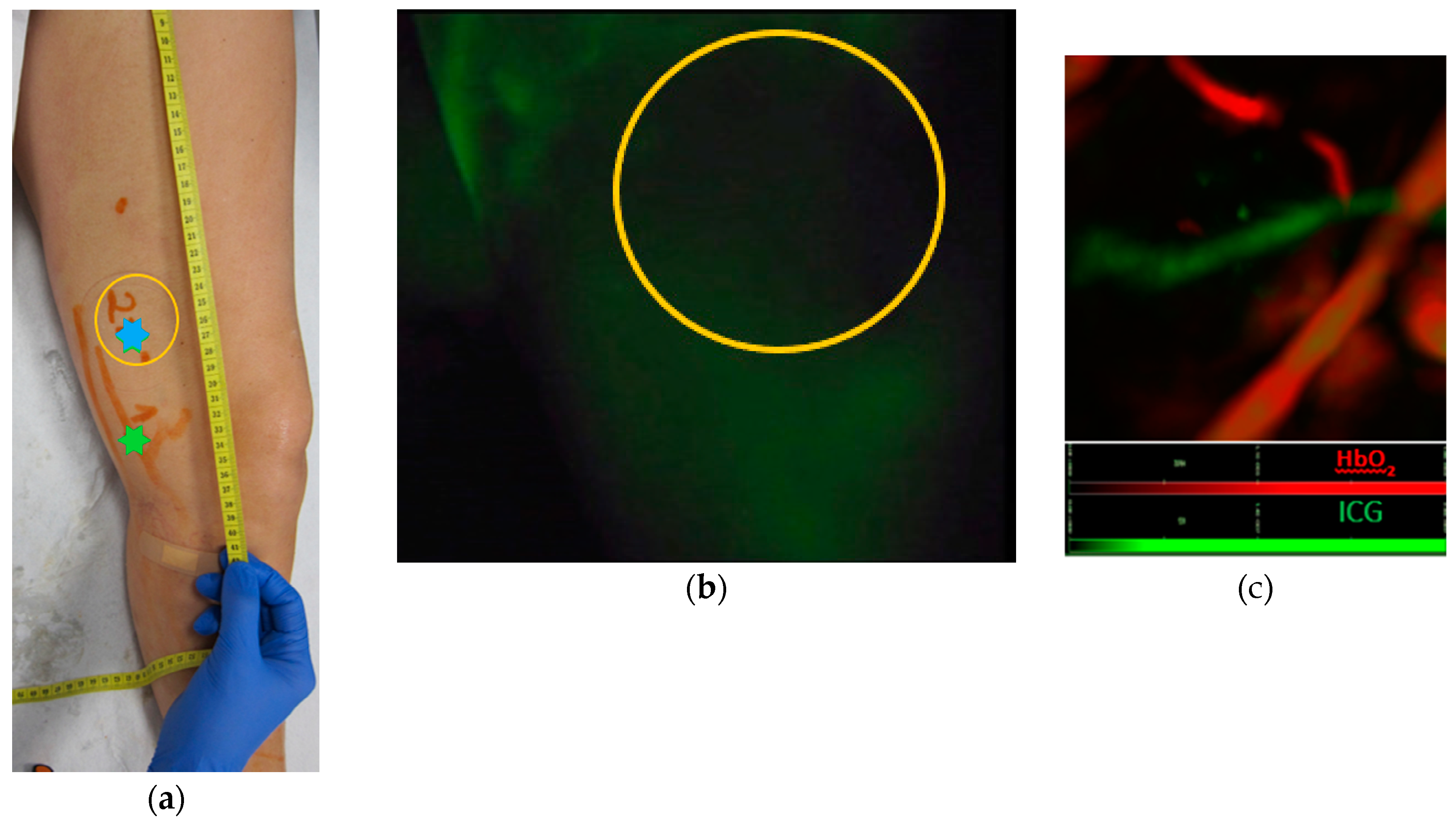 Jcm 09 00815 g003 Jcm 09 00815 g003