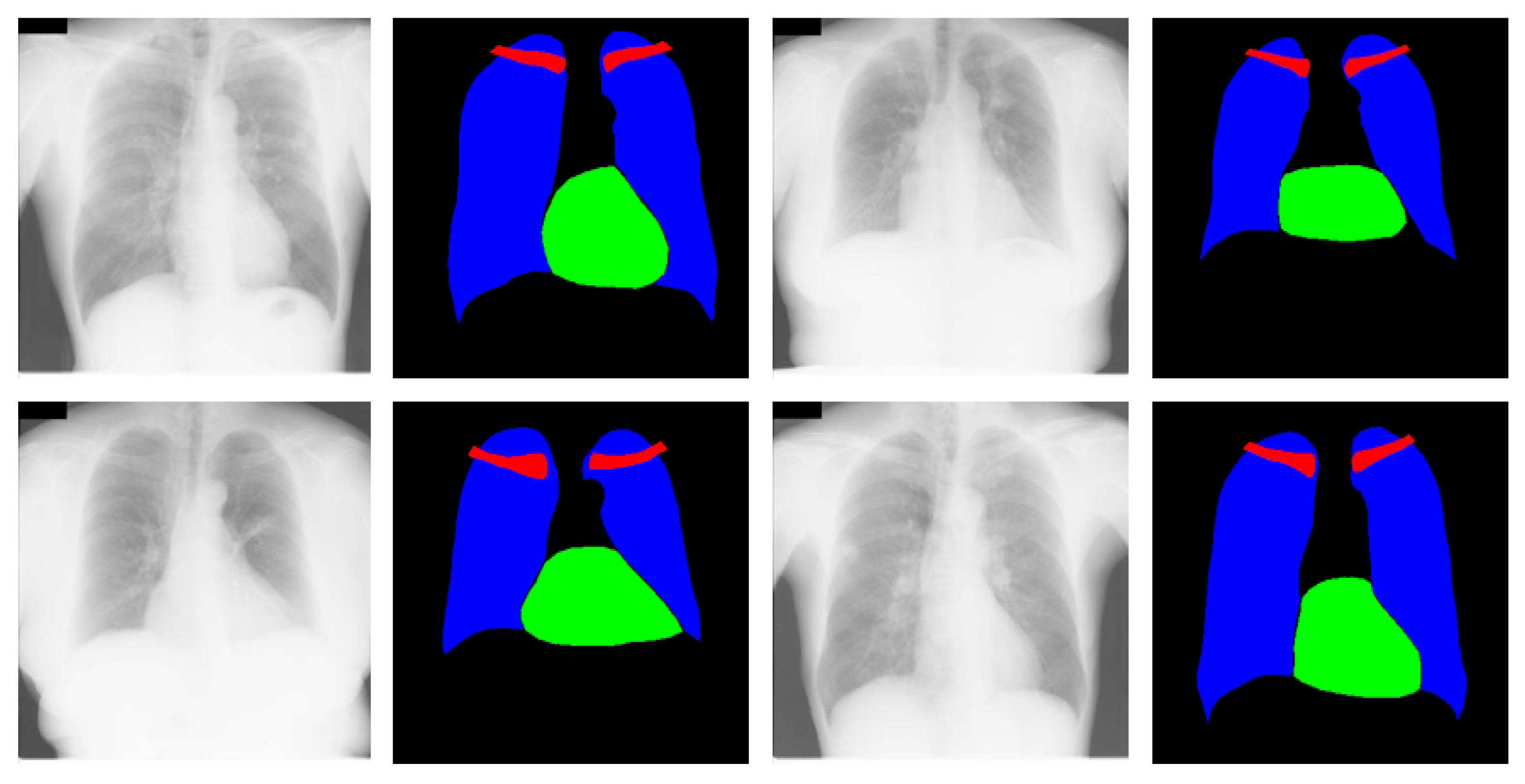 Jcm 09 00871 g004 Jcm 09 00871 g004