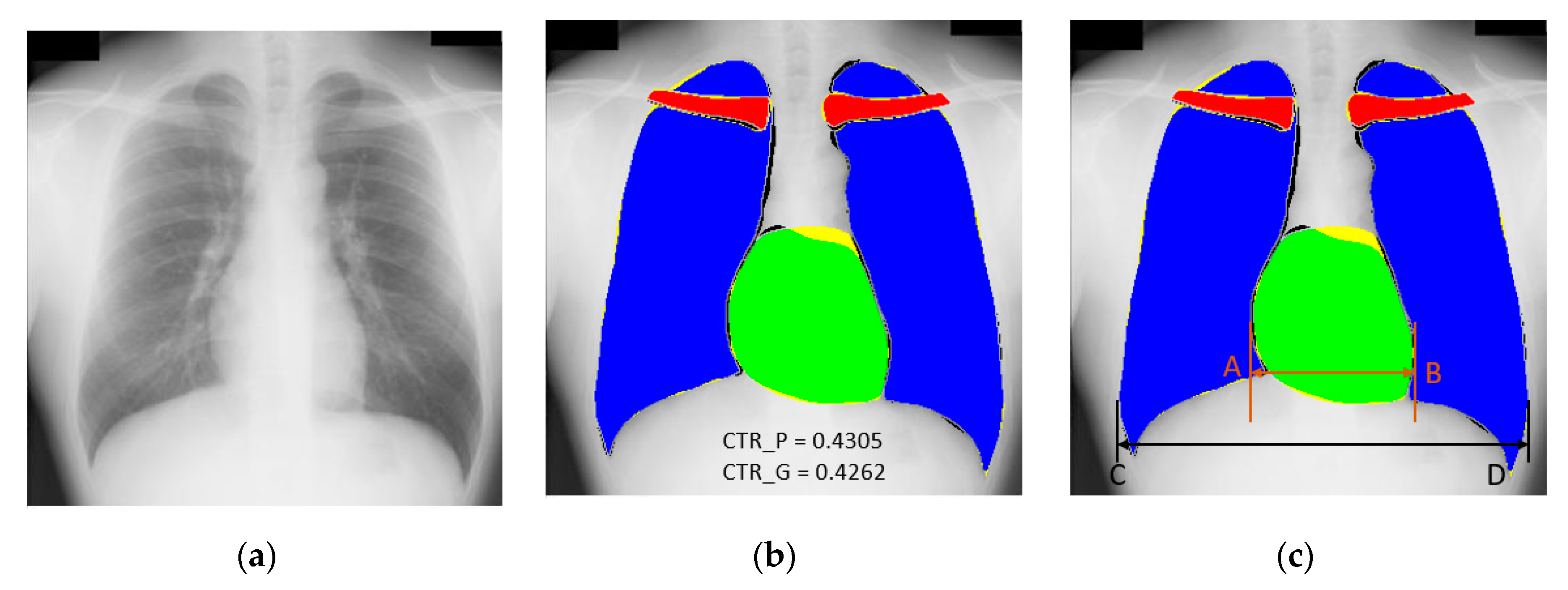 Jcm 09 00871 g011 Jcm 09 00871 g011