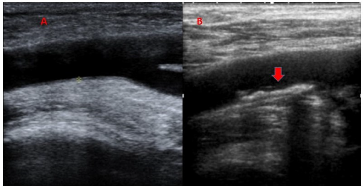 Jcm 09 00971 g001 Jcm 09 00971 g001