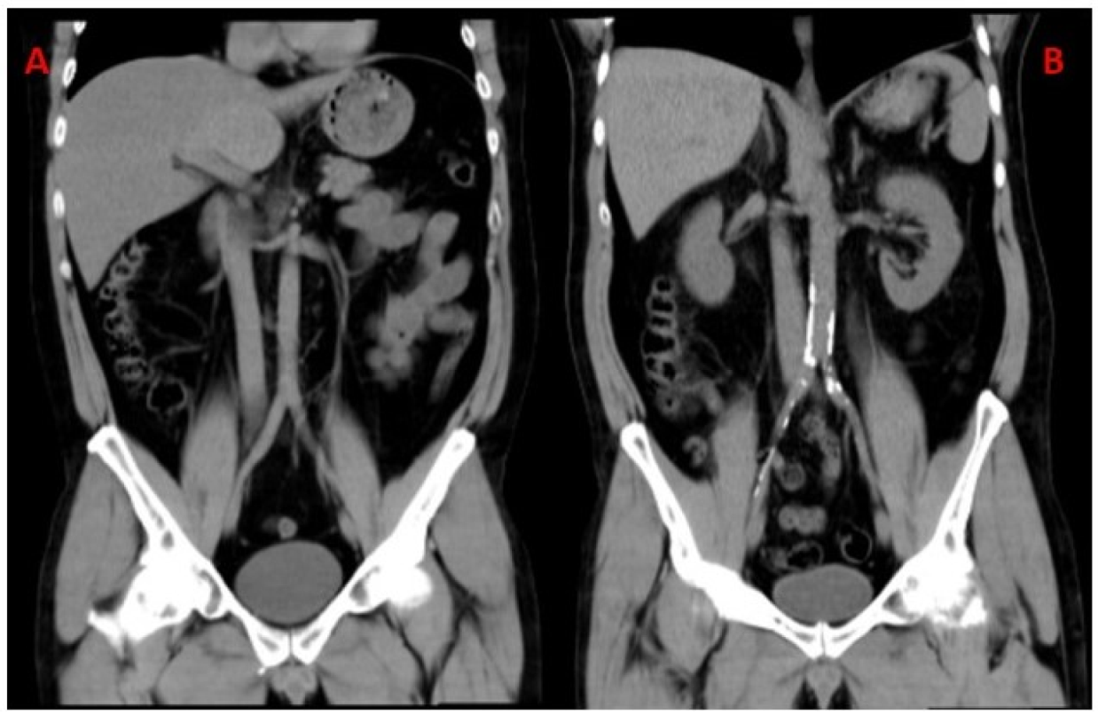 Jcm 09 00971 g002 Jcm 09 00971 g002