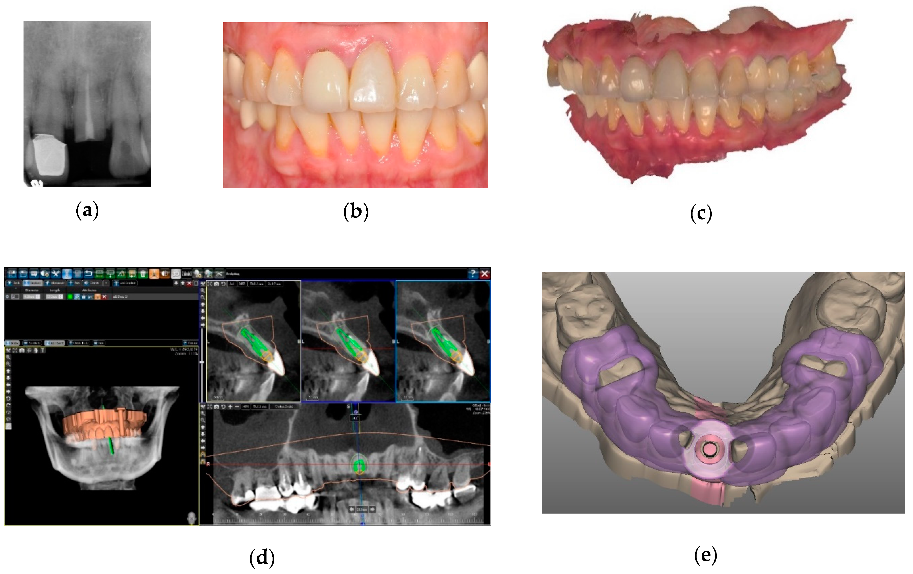 Teeth model Enlarged version Oral pathology model of dental dental