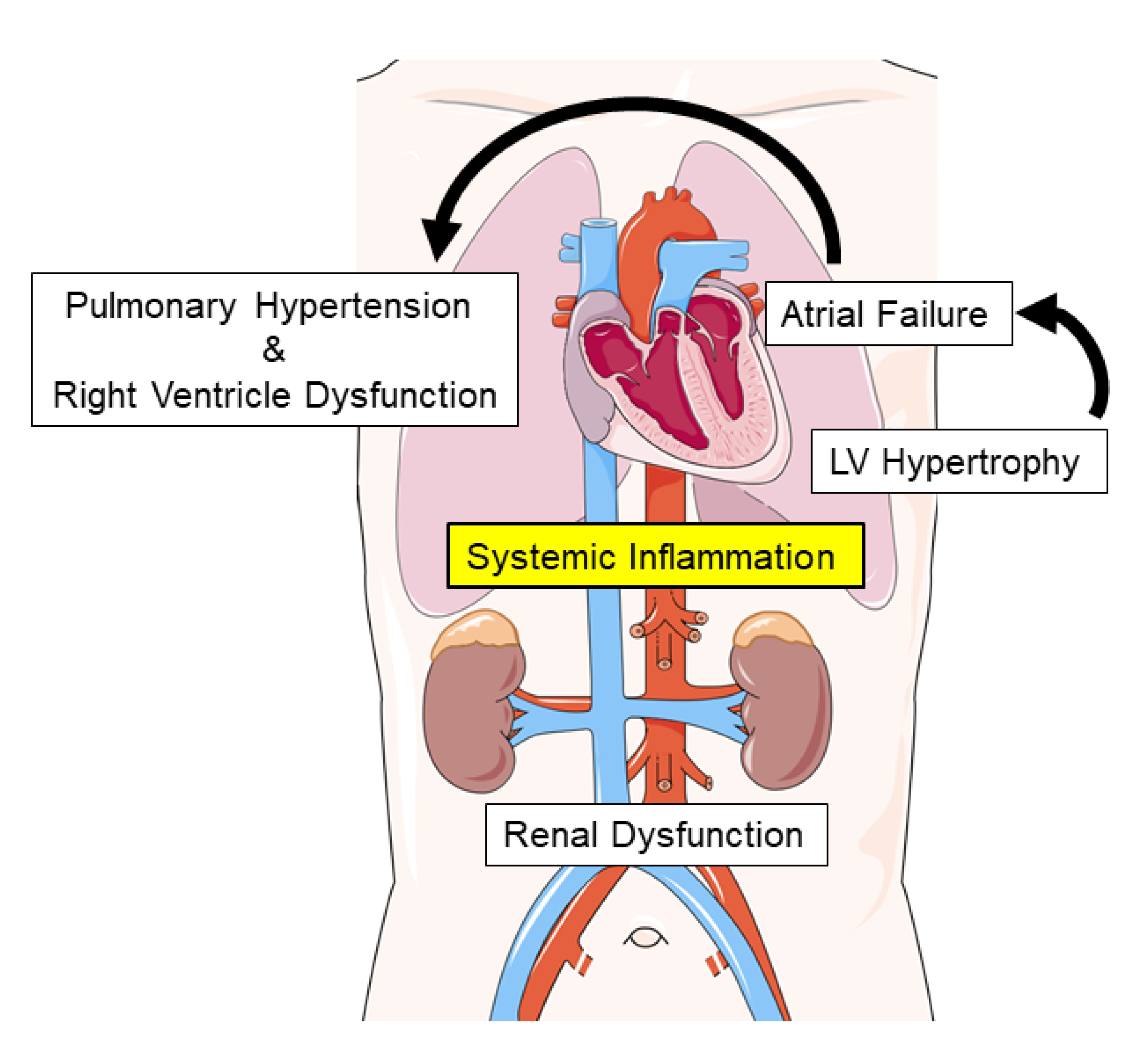 Asymptomatic Left Ventricle Systolic Dysfunction