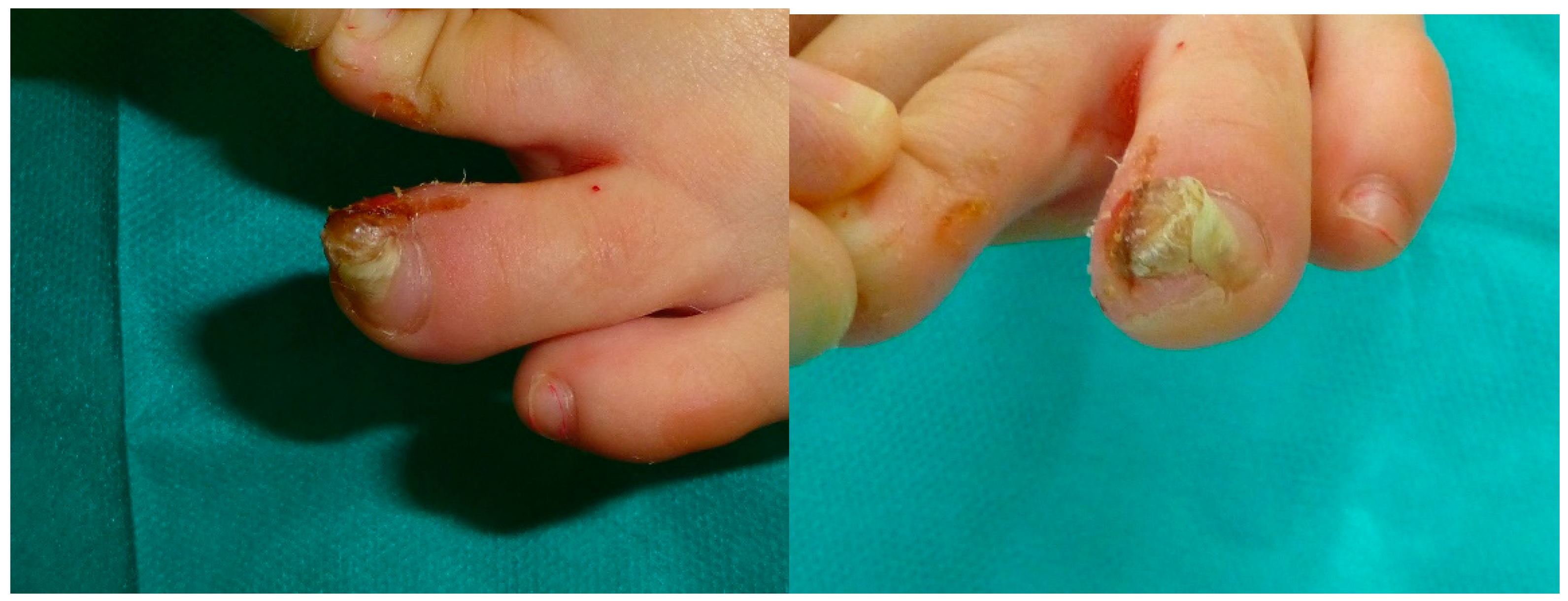 Jcm 09 01122 g002 Jcm 09 01122 g002