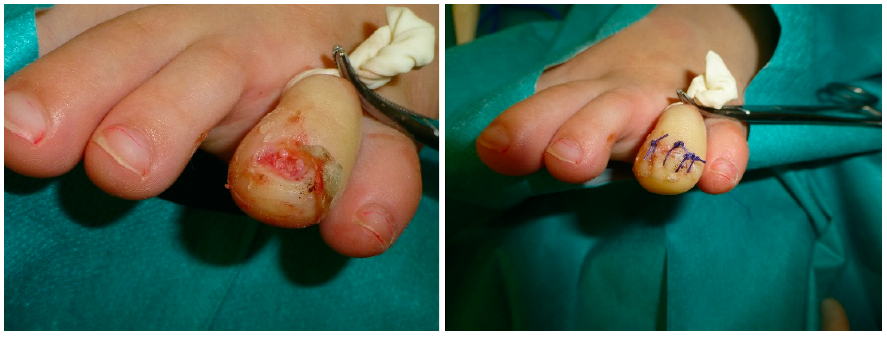 Jcm 09 01122 g003 Jcm 09 01122 g003