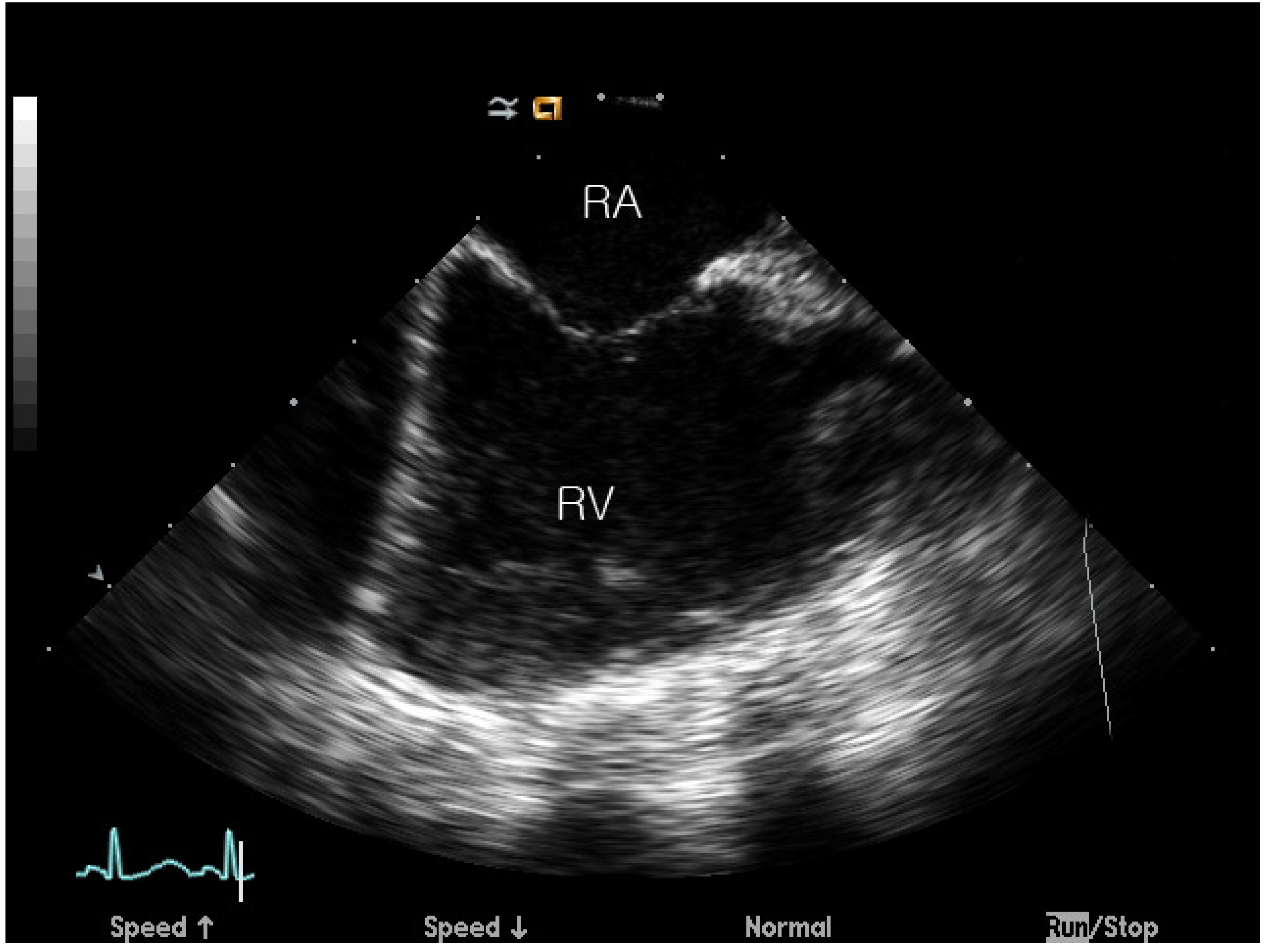 Jcm 09 01132 g001 Jcm 09 01132 g001