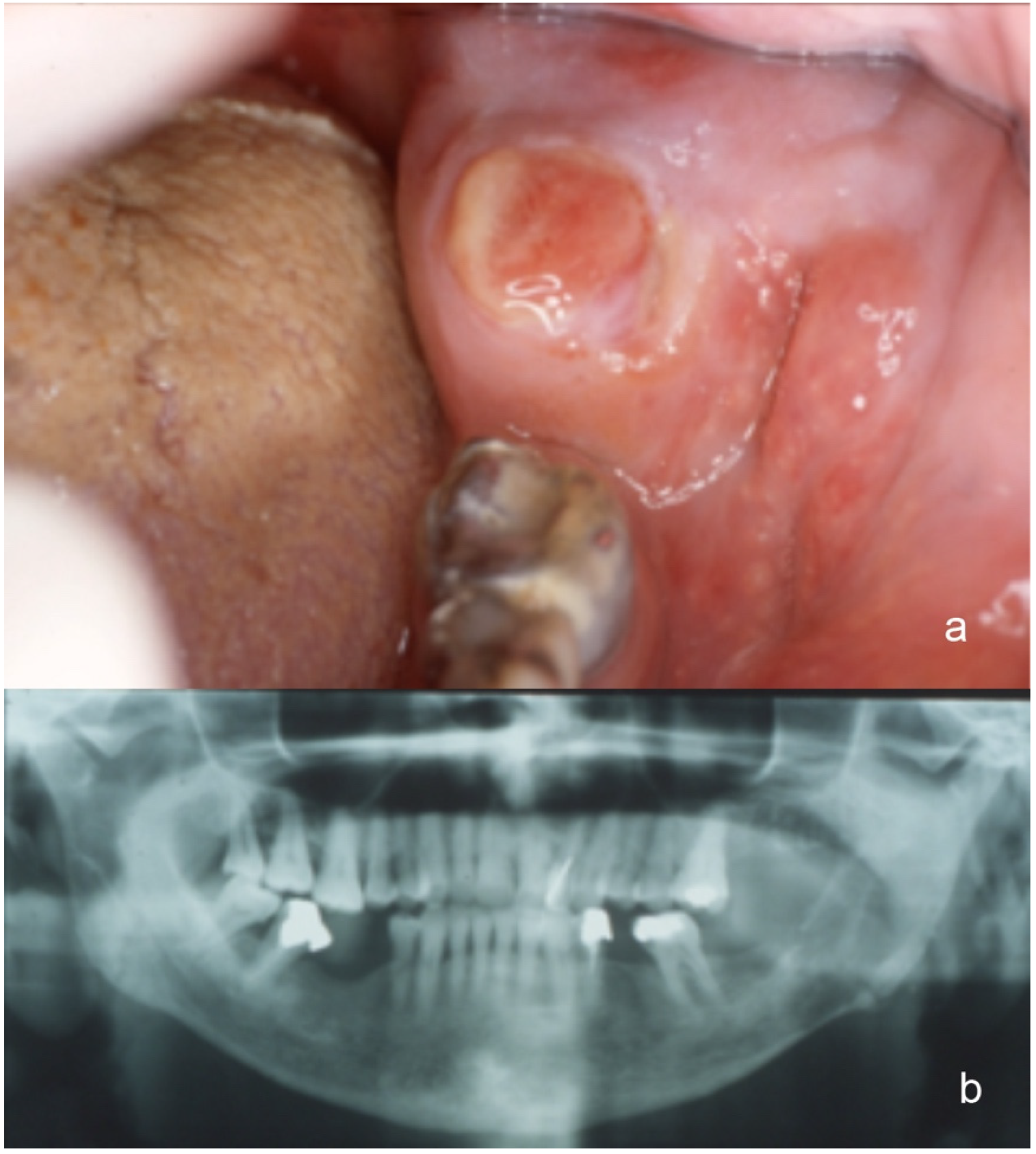 Jcm 09 01151 g001 Jcm 09 01151 g001