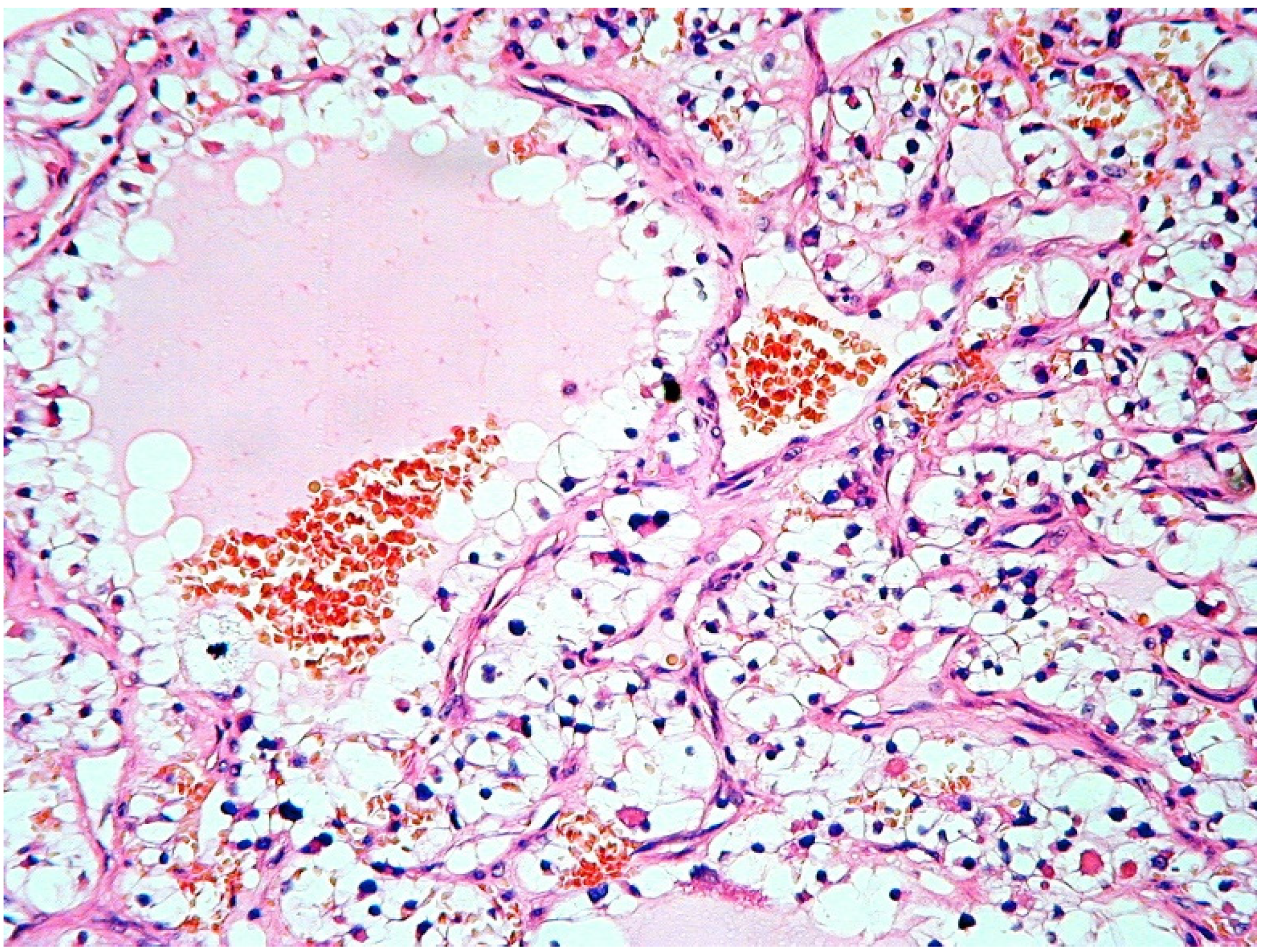 Jcm 09 01151 g003 Jcm 09 01151 g003