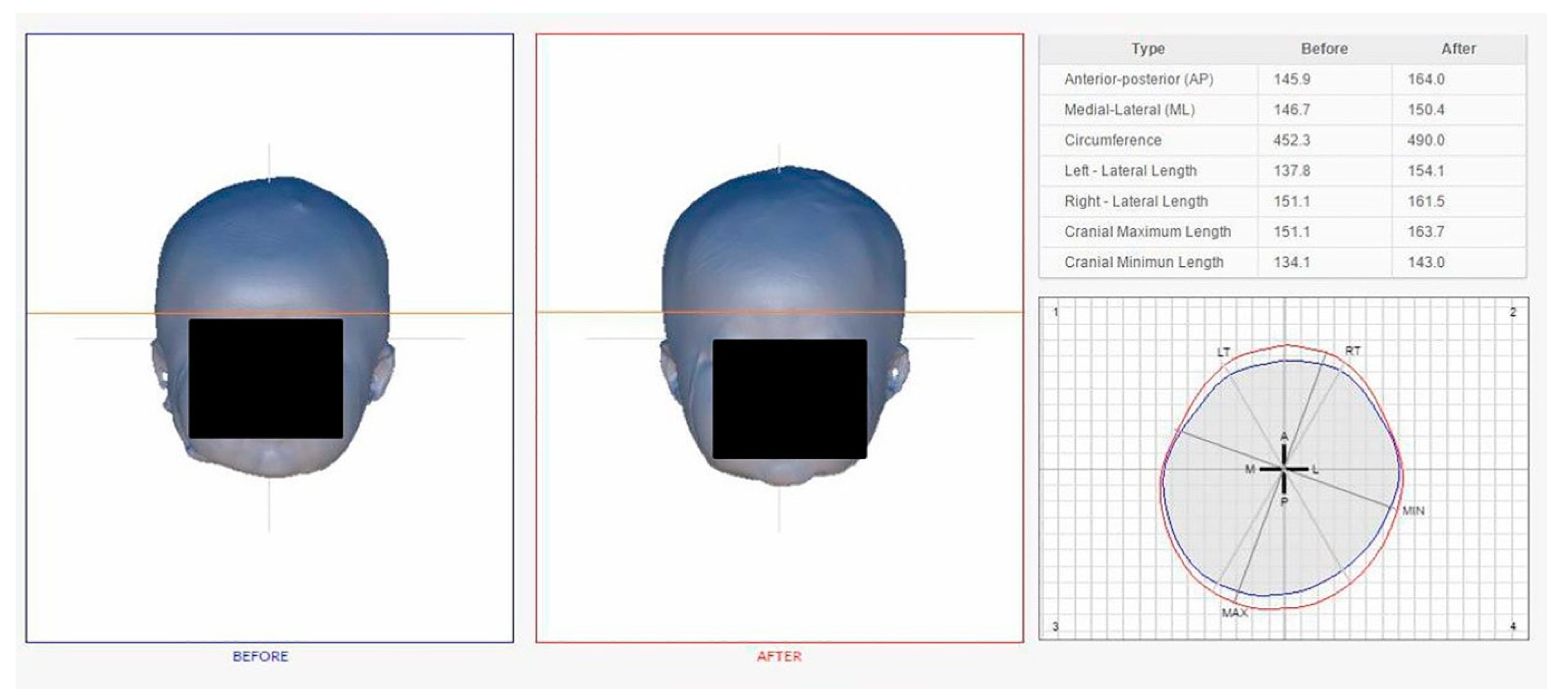 Jcm 09 01171 g003 Jcm 09 01171 g003