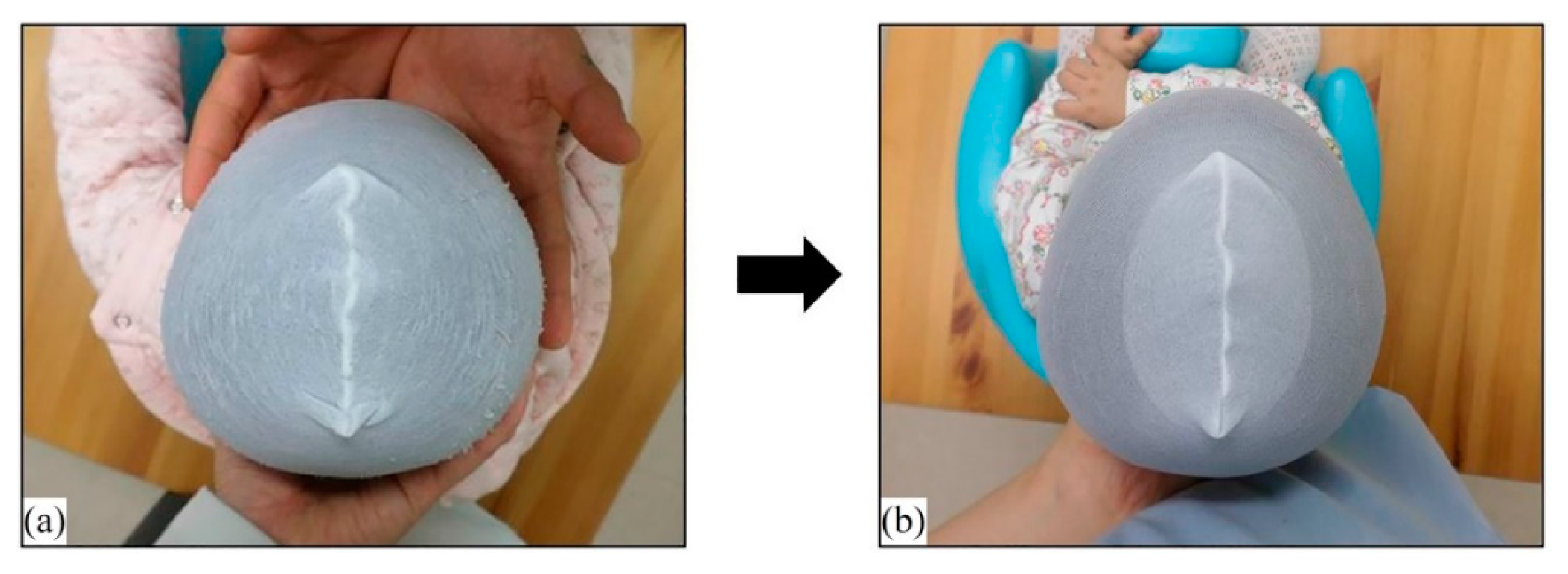 Jcm 09 01171 g004 Jcm 09 01171 g004