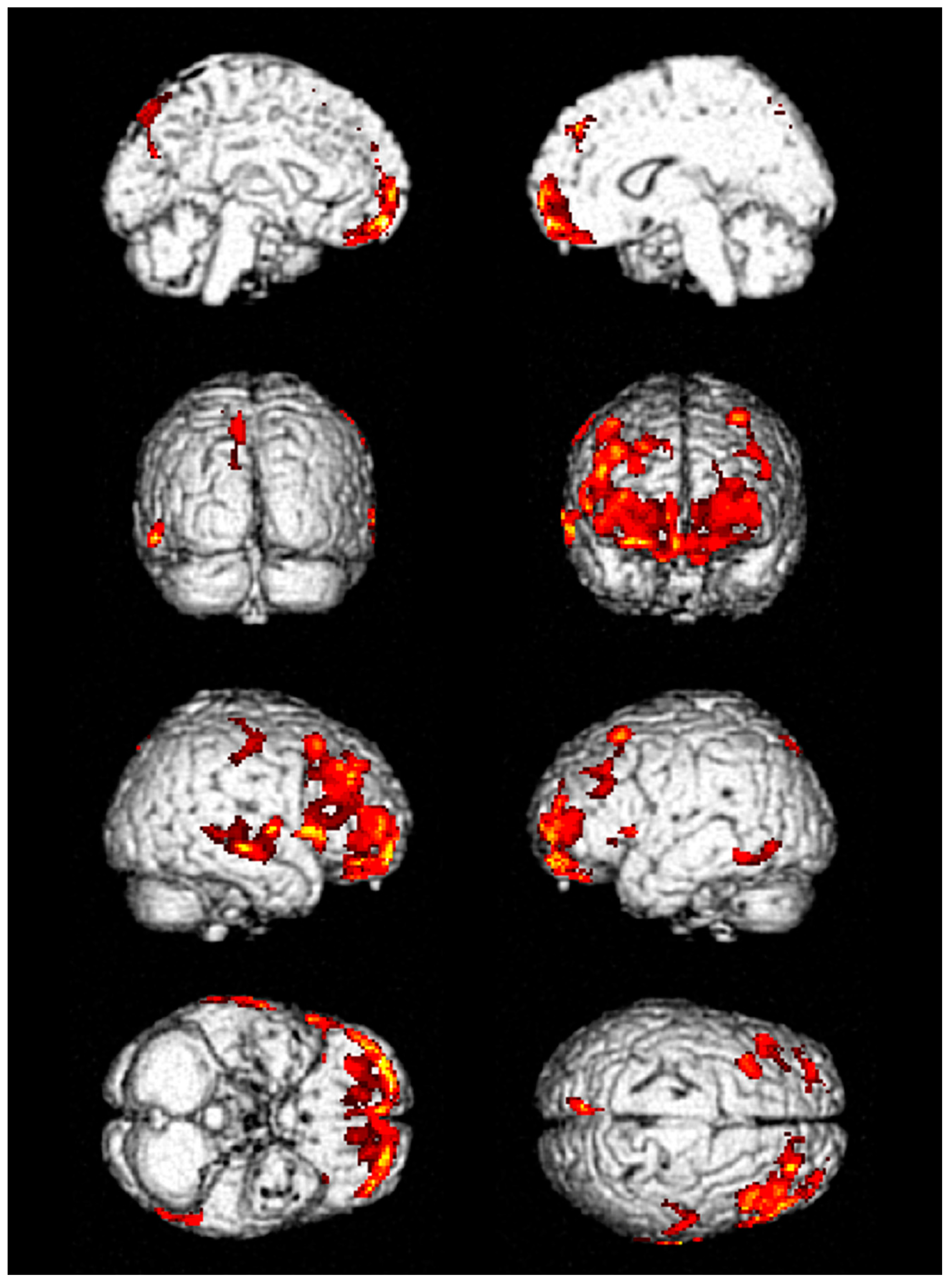 Jcm 09 01213 g002 Jcm 09 01213 g002