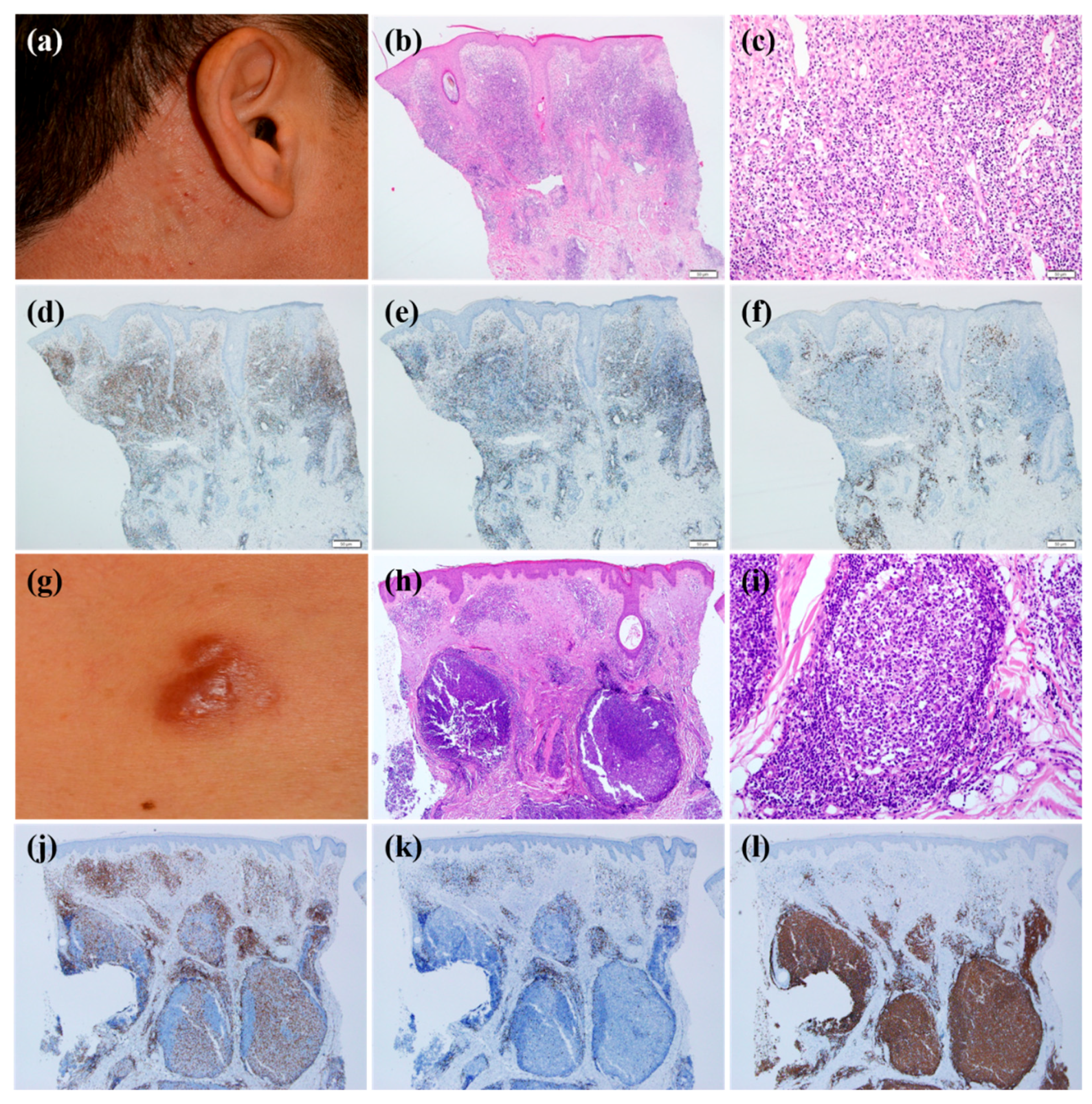 JCM Free FullText Clinical and Histopathological Characteristics