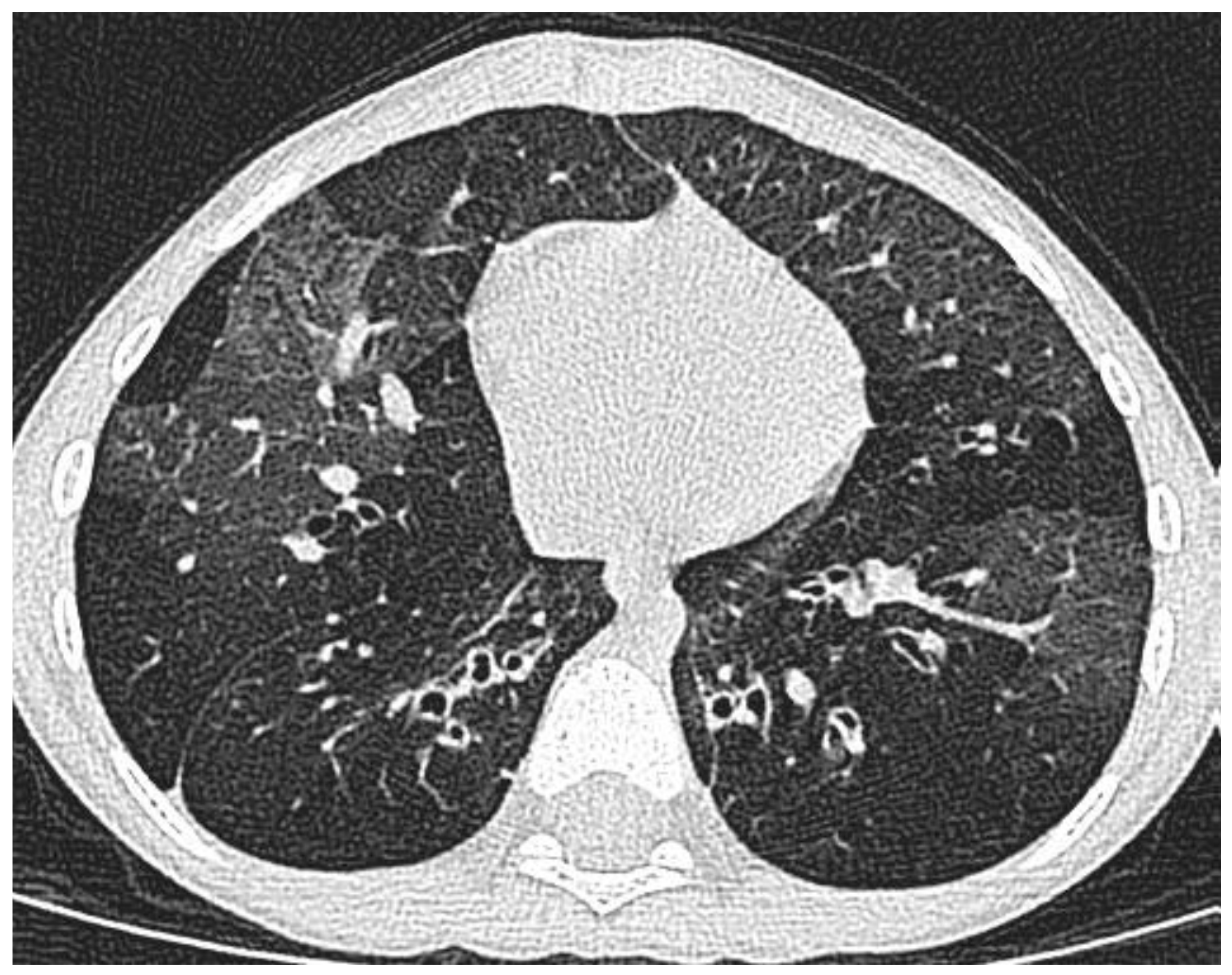 Jcm 09 01237 g002 Jcm 09 01237 g002