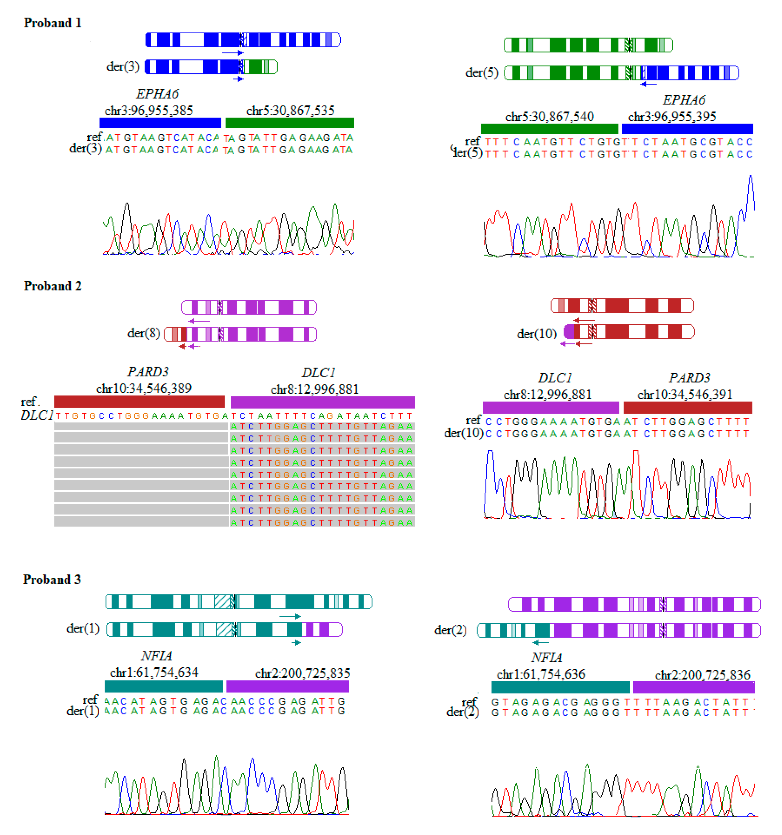 Jcm Free Full Text Breakpoint Mapping Of Symptomatic Balanced Translocations Links The Epha6 Klf13 And Ubr3 Genes To Novel Disease Phenotype Html