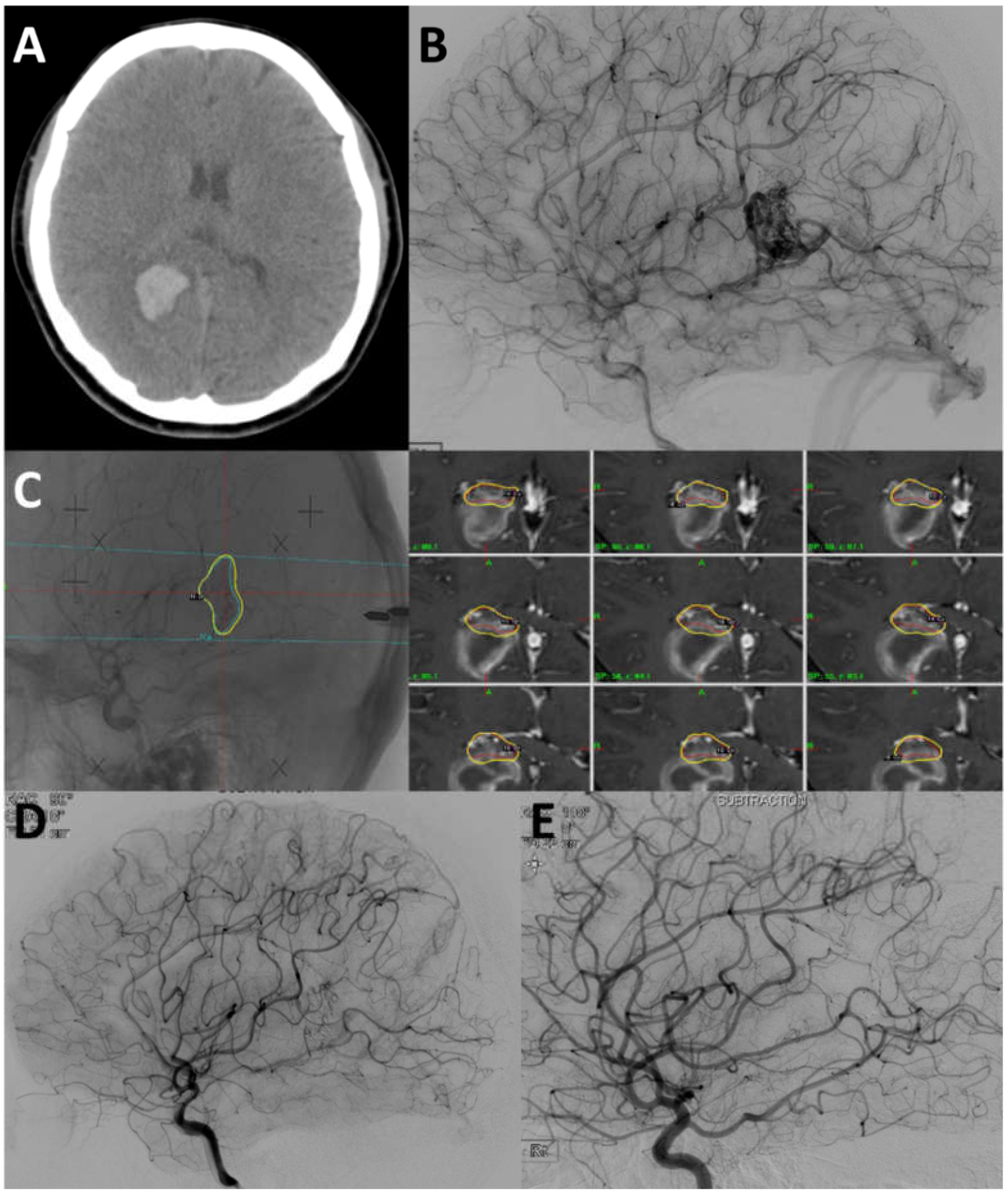 Jcm 09 01318 g003 Jcm 09 01318 g003