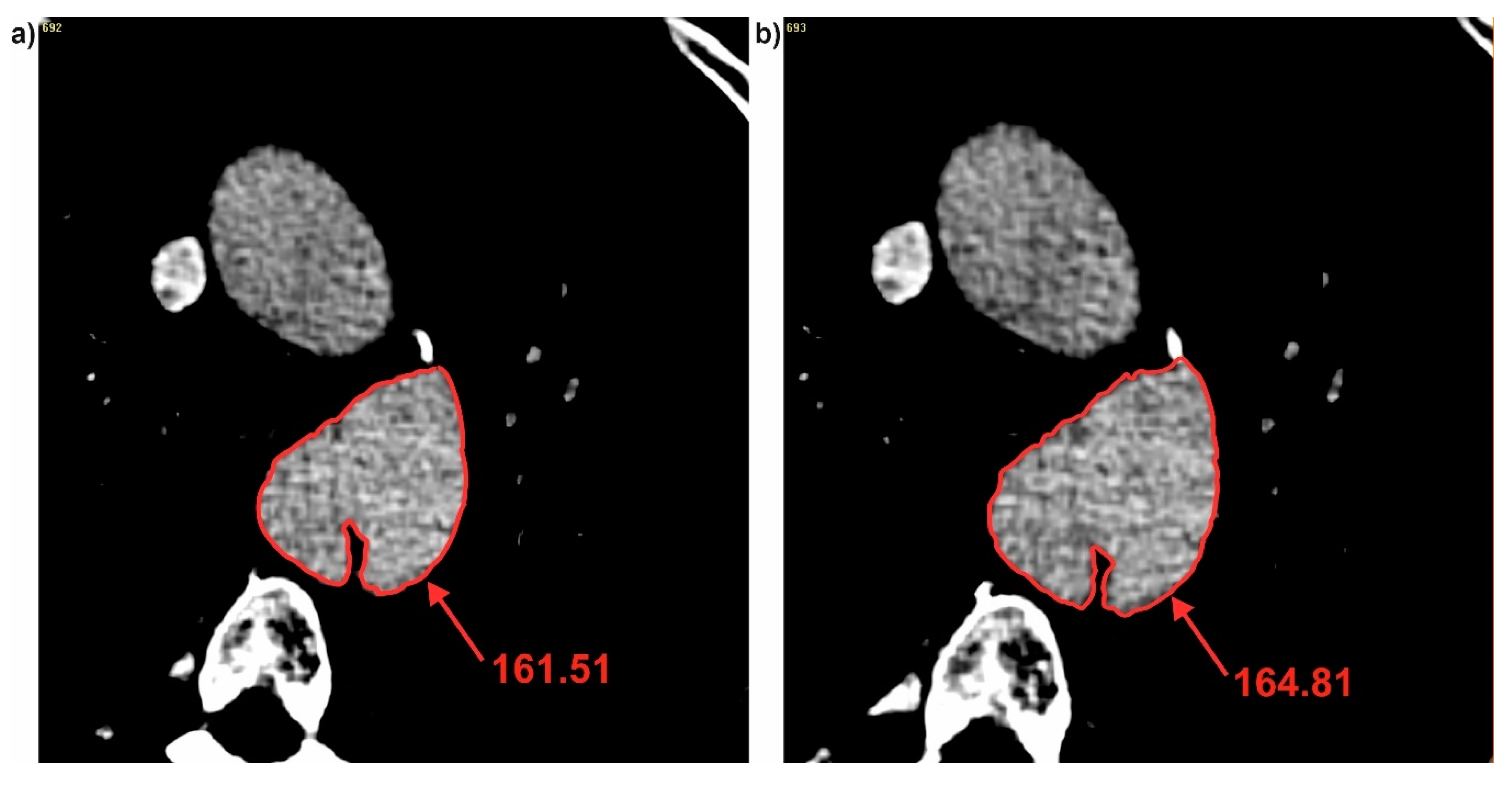 Jcm 09 01330 g006 Jcm 09 01330 g006