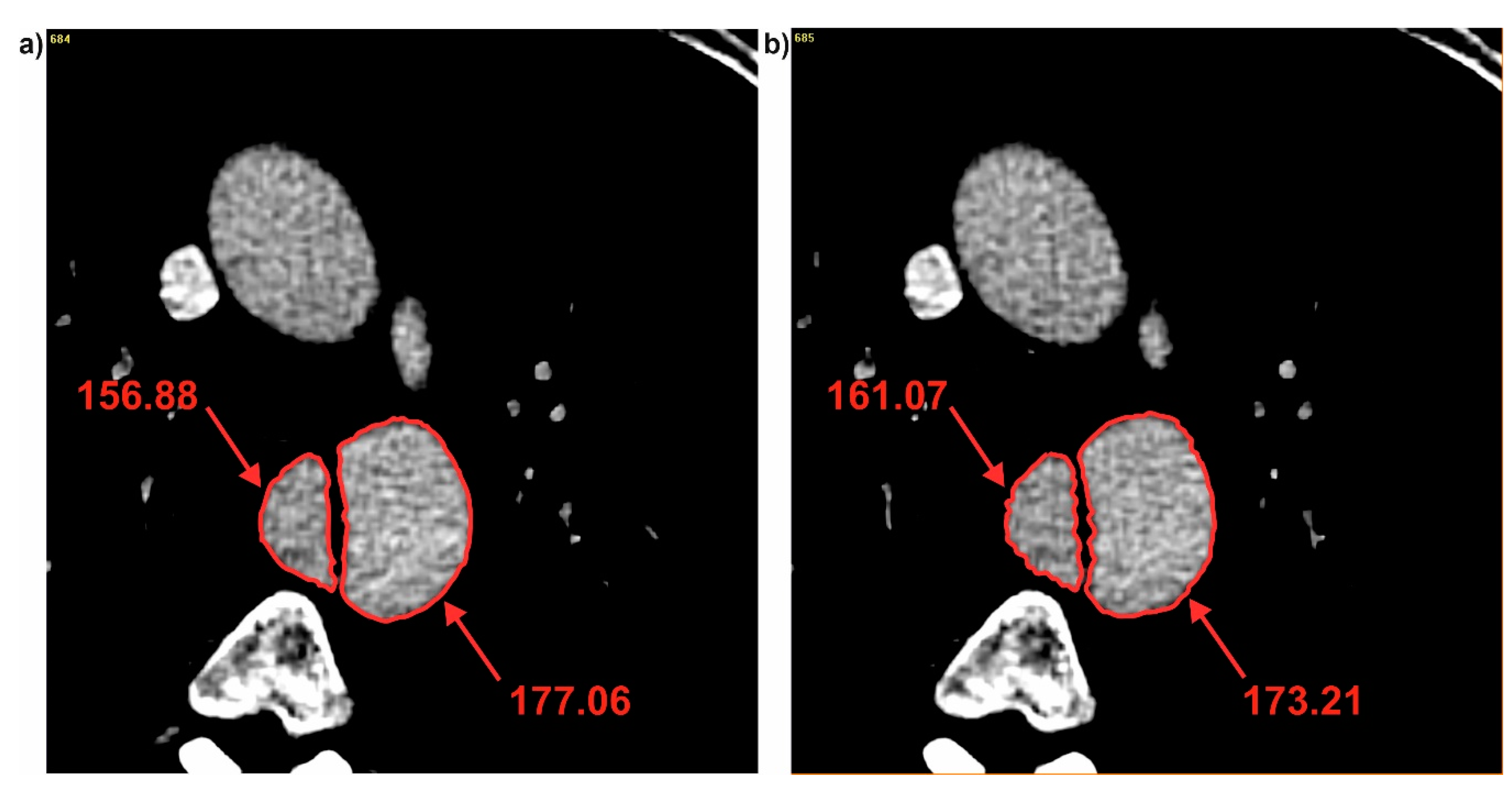 Jcm 09 01330 g007 Jcm 09 01330 g007