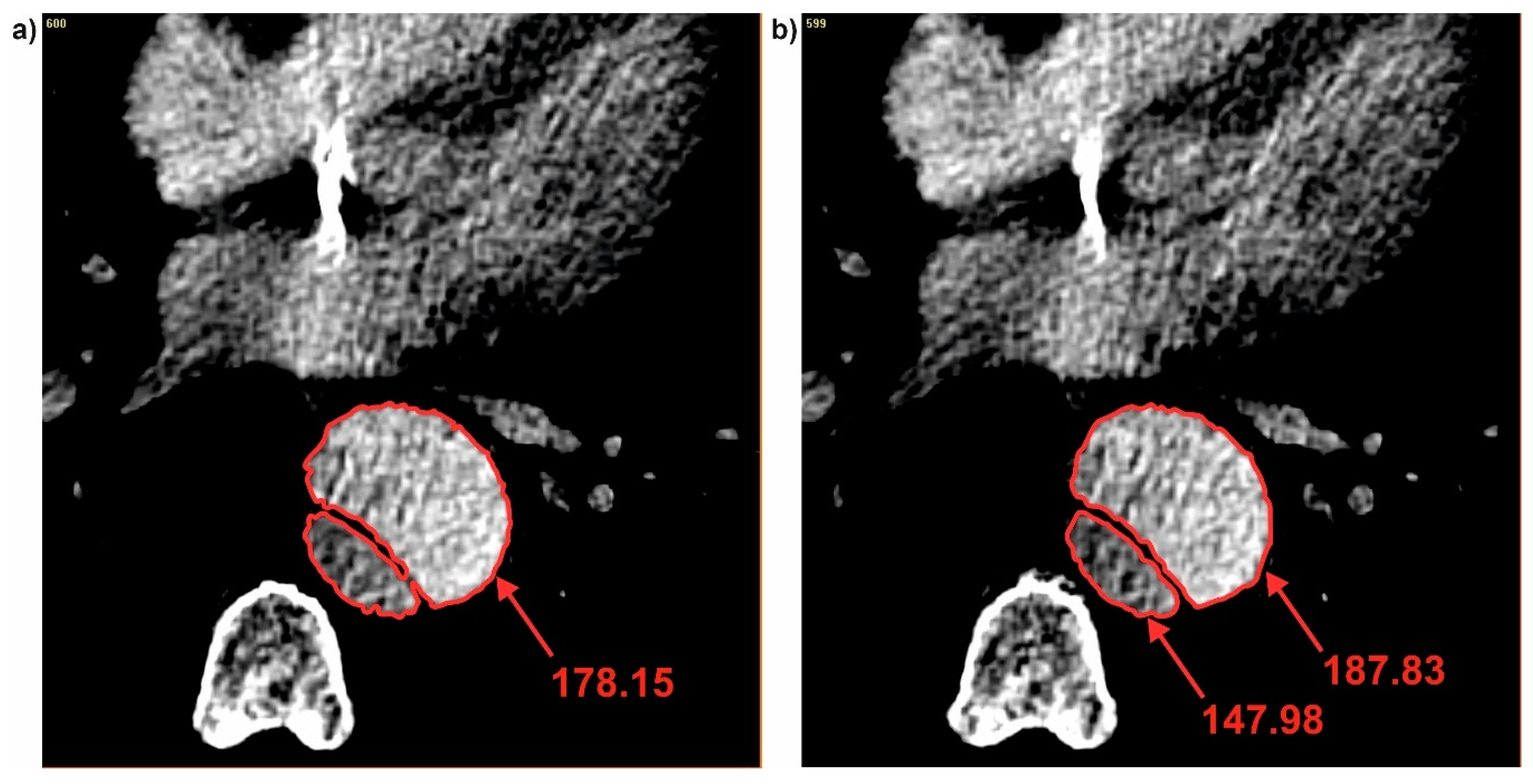 Jcm 09 01330 g008 Jcm 09 01330 g008