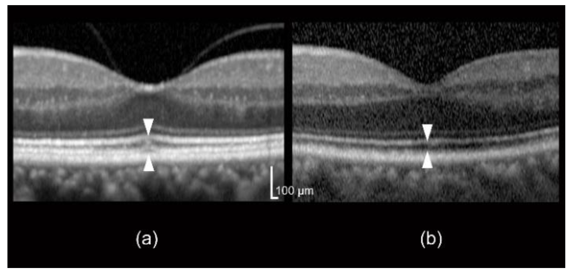 Jcm 09 01347 g004 Jcm 09 01347 g004