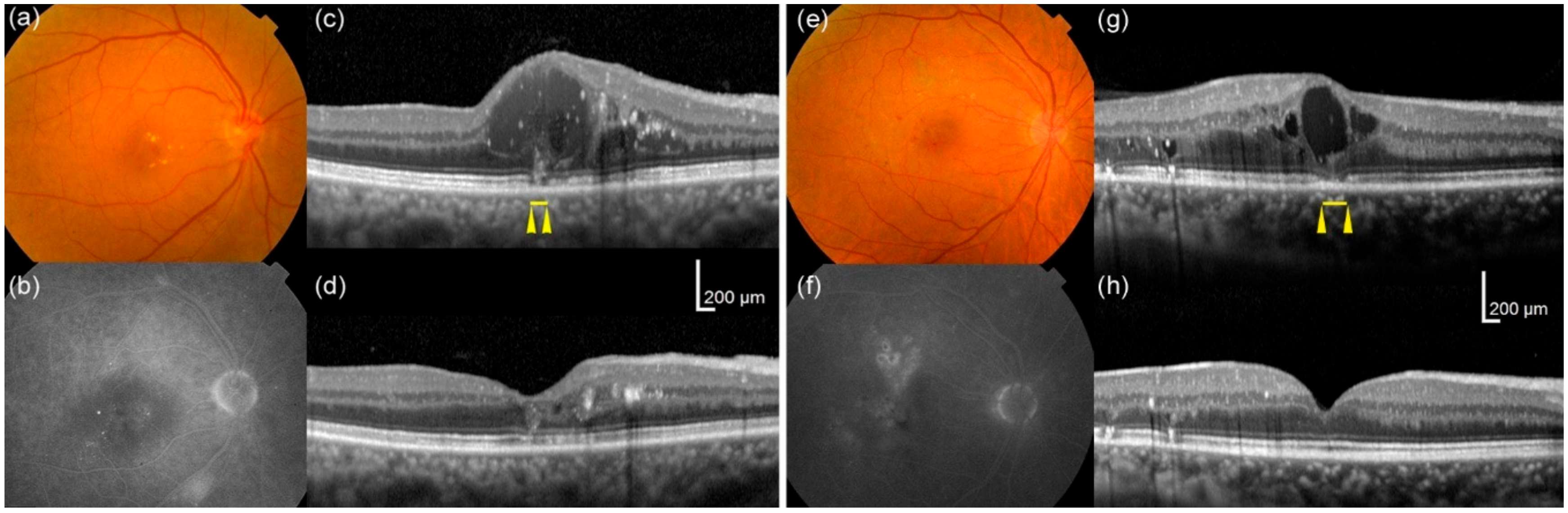 Jcm 09 01391 g003 Jcm 09 01391 g003