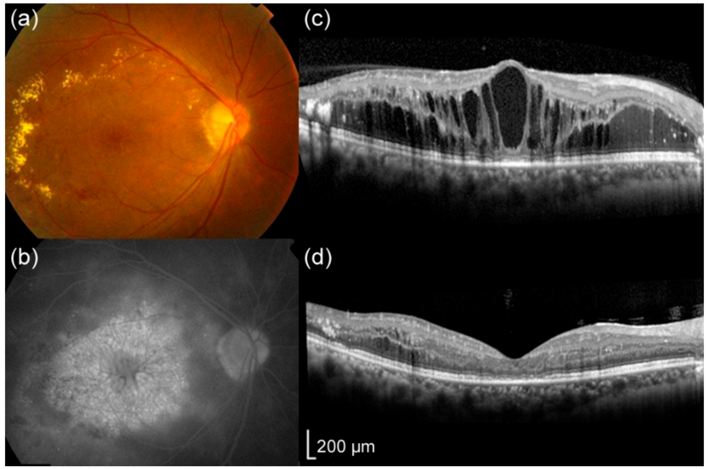 Jcm 09 01391 g006 Jcm 09 01391 g006