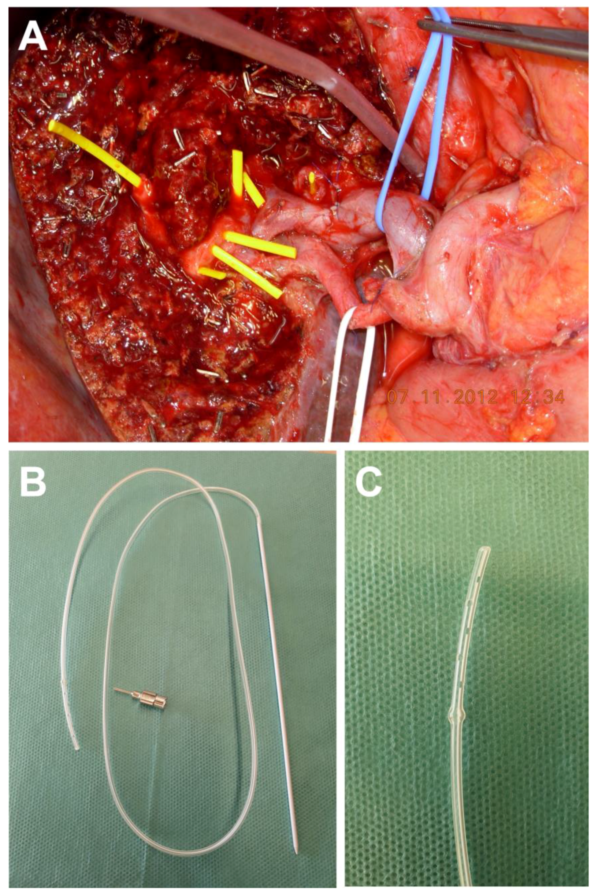 Jcm 09 01392 g001 Jcm 09 01392 g001