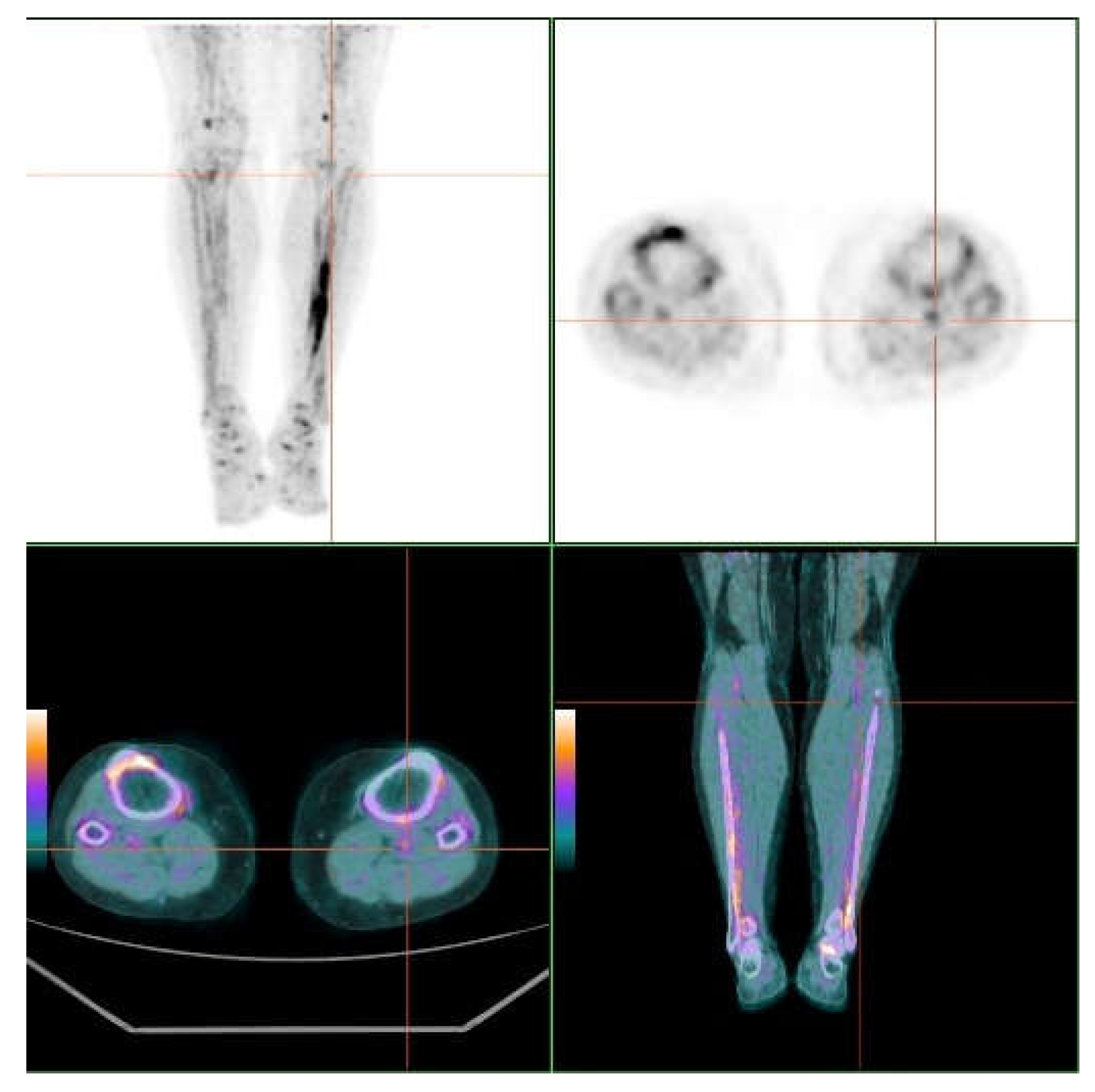 Jcm 09 01393 g002 Jcm 09 01393 g002