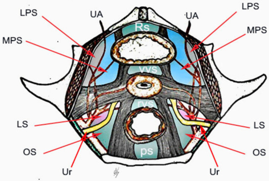 JCM | Free Full-Text | Avascular Spaces of the Female Pelvis—Clinical