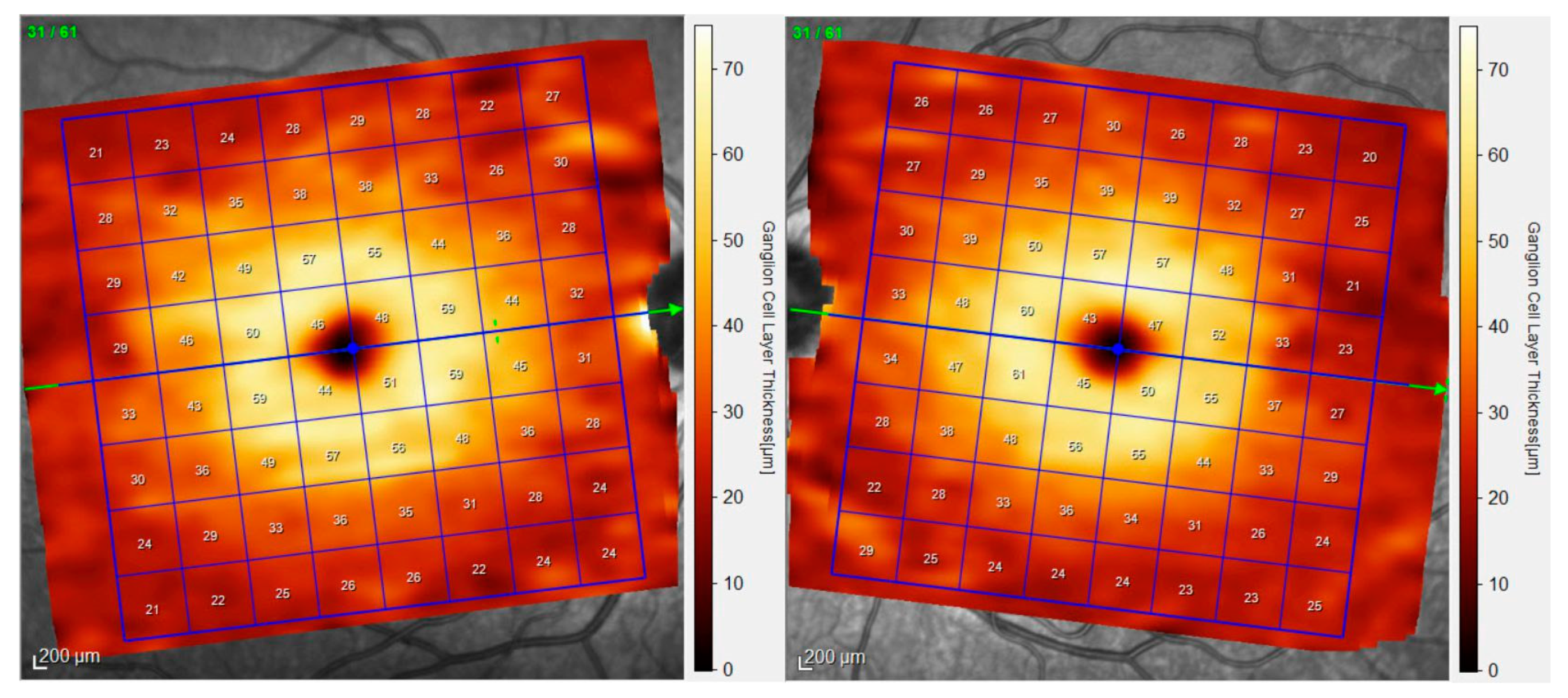 Jcm 09 01503 g001 Jcm 09 01503 g001
