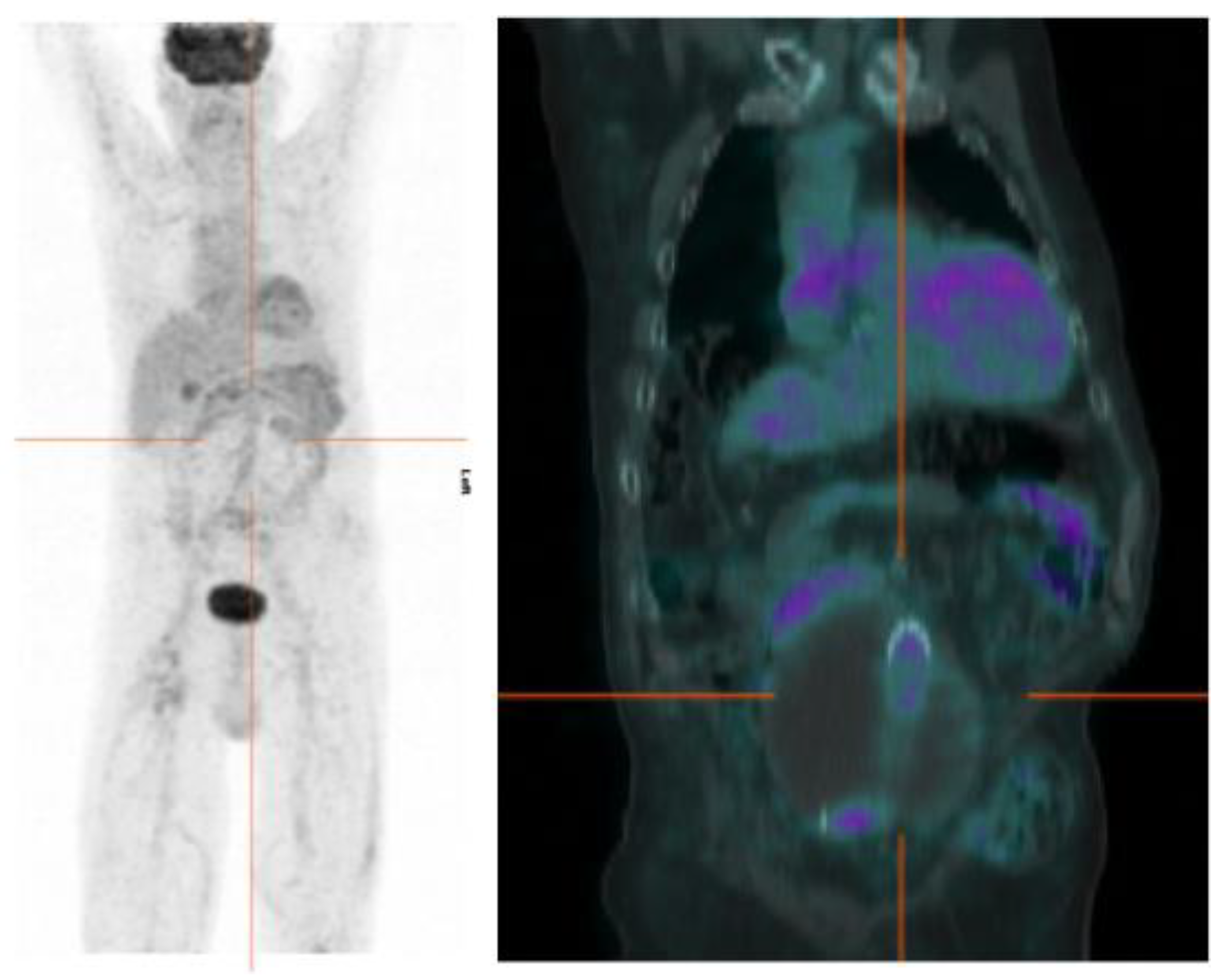 JCM   Free Full Text   Imaging Modalities for the Diagnosis of ...