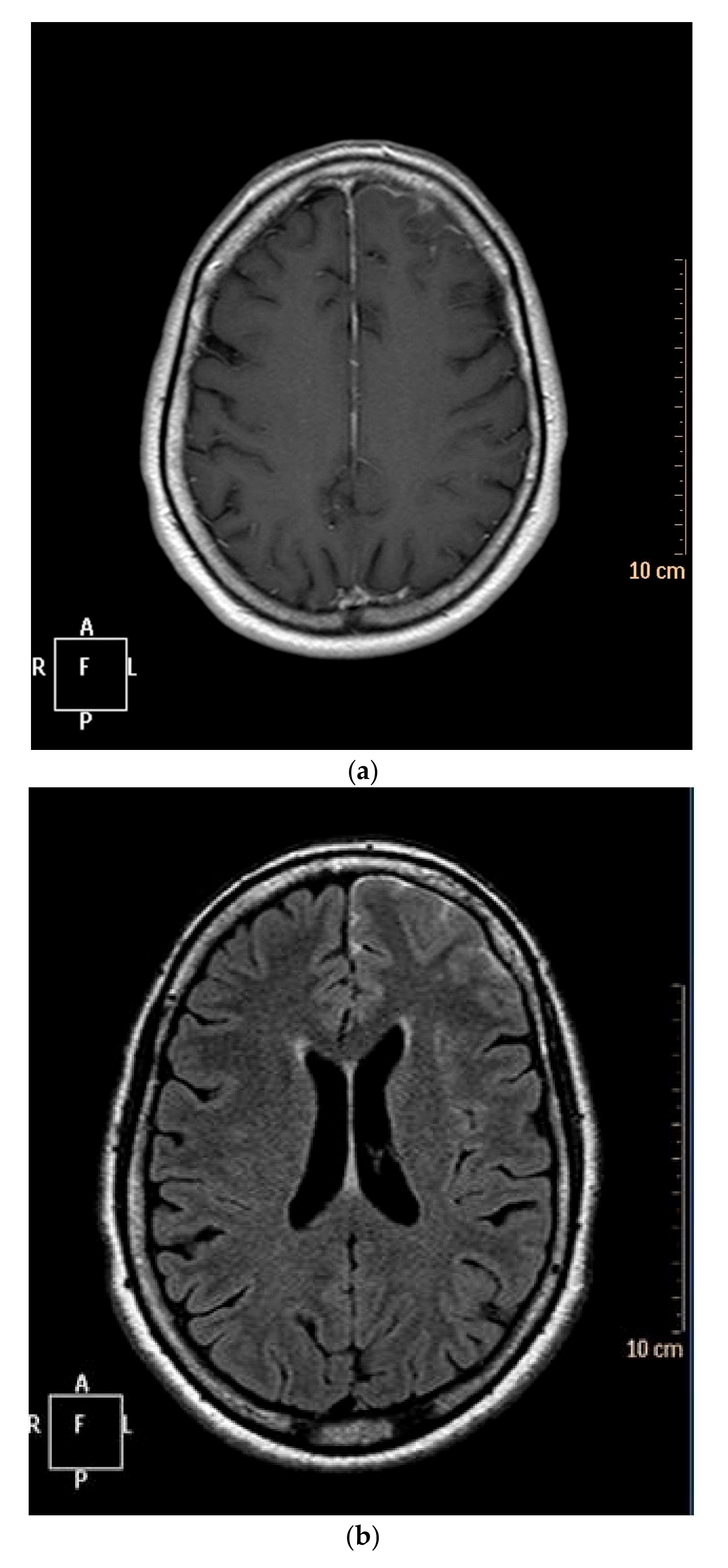 Jcm 09 01625 g001 Jcm 09 01625 g001