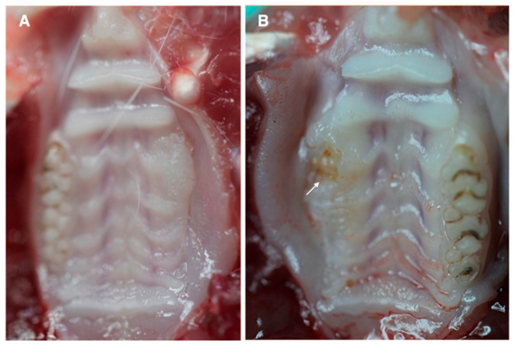 JCM Free FullText Allogeneic Bone Marrow Mesenchymal Stem Cell