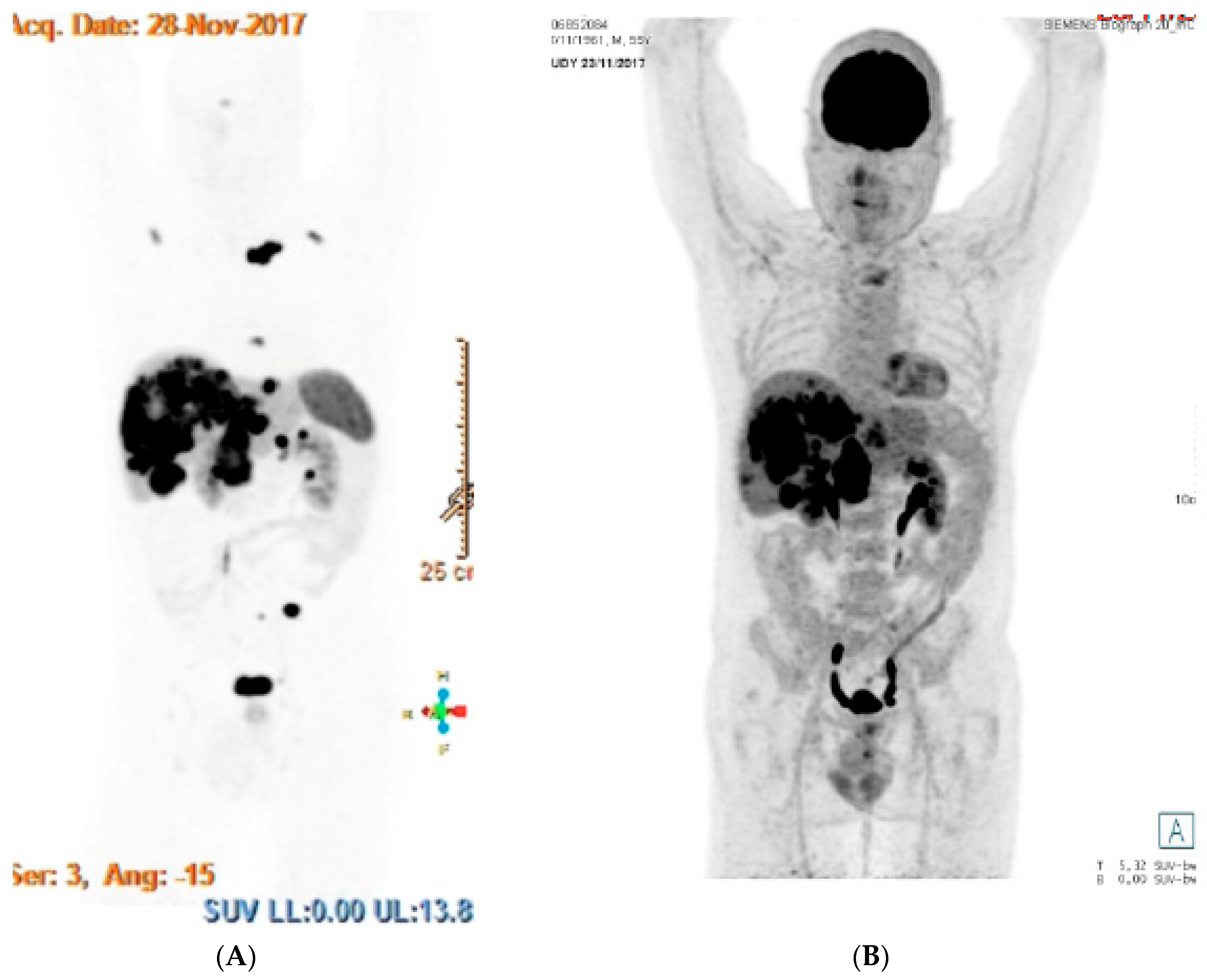 Jcm 09 01677 g001 Jcm 09 01677 g001