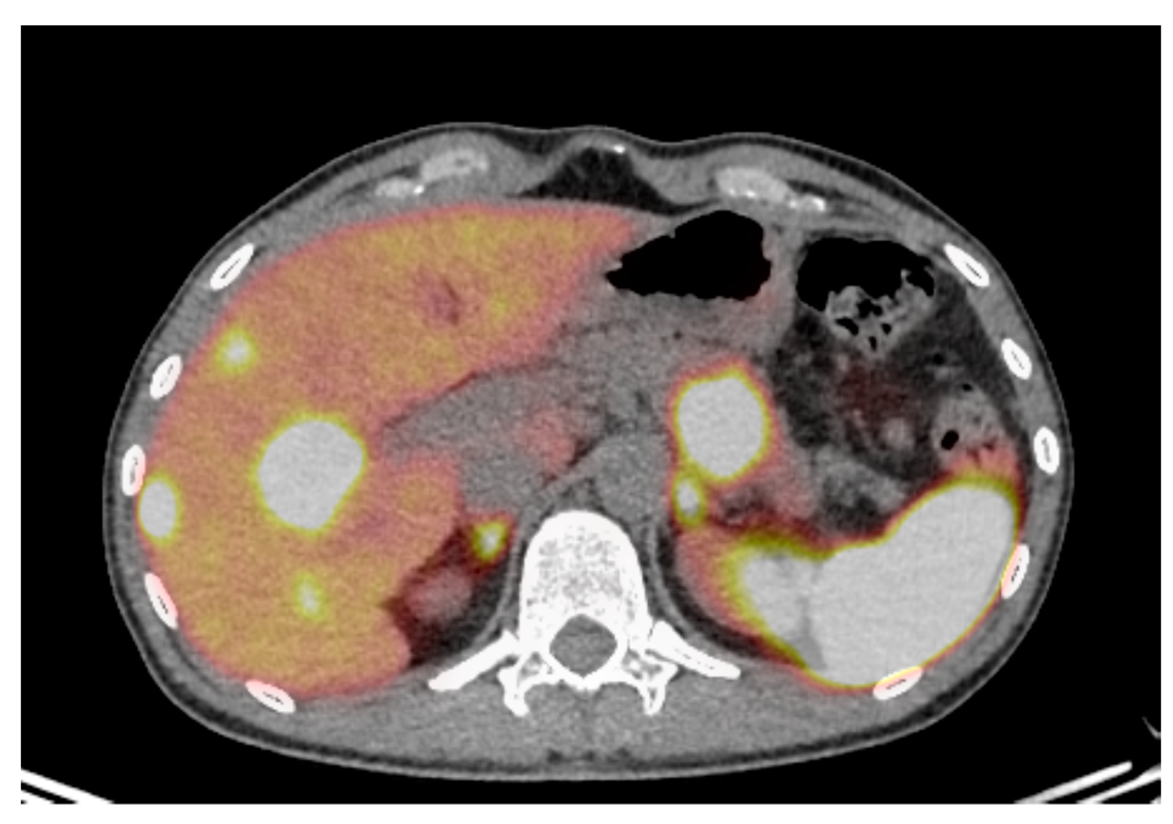 Jcm 09 01860 g002 Jcm 09 01860 g002