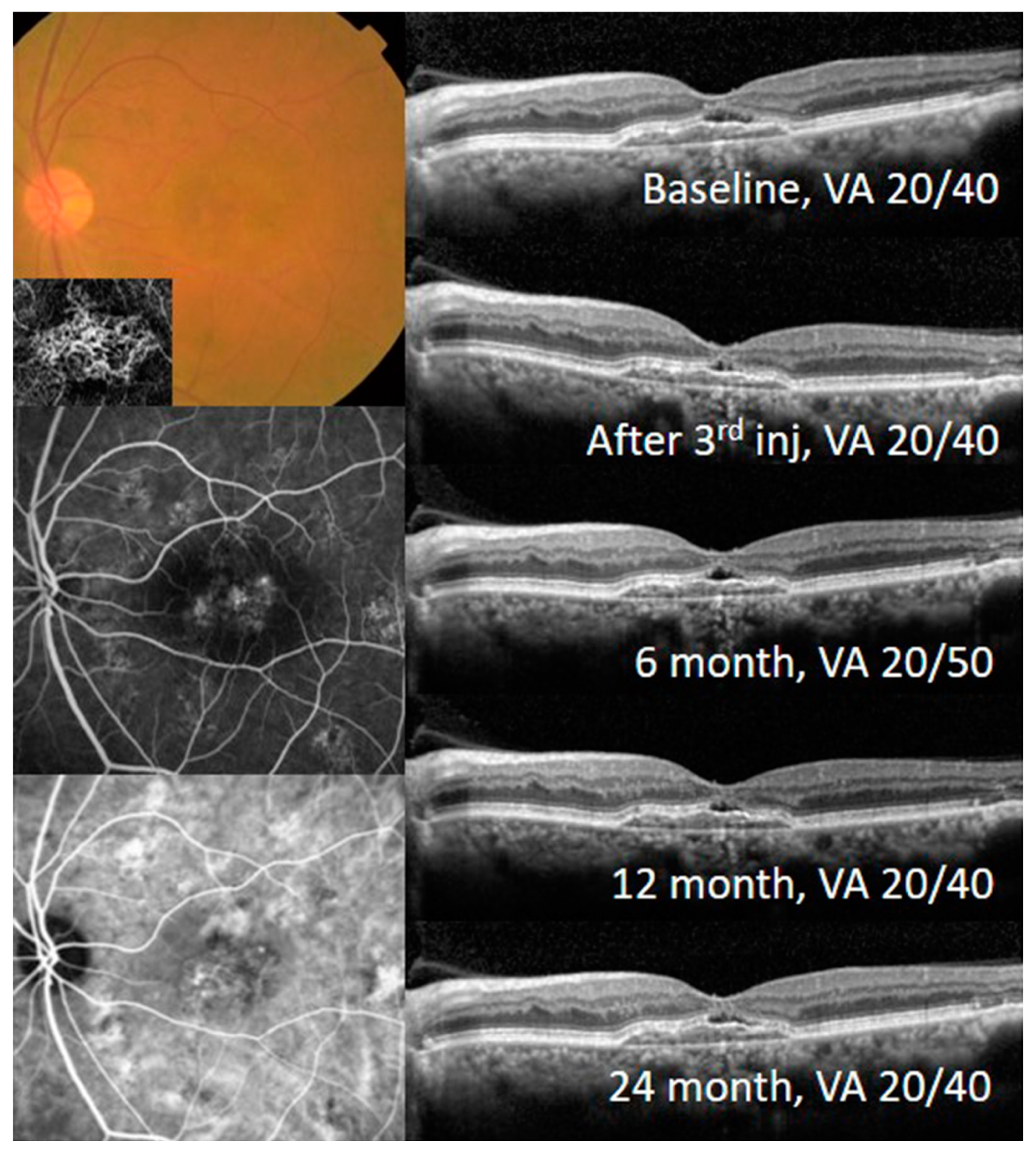 Jcm 09 01863 g003 Jcm 09 01863 g003