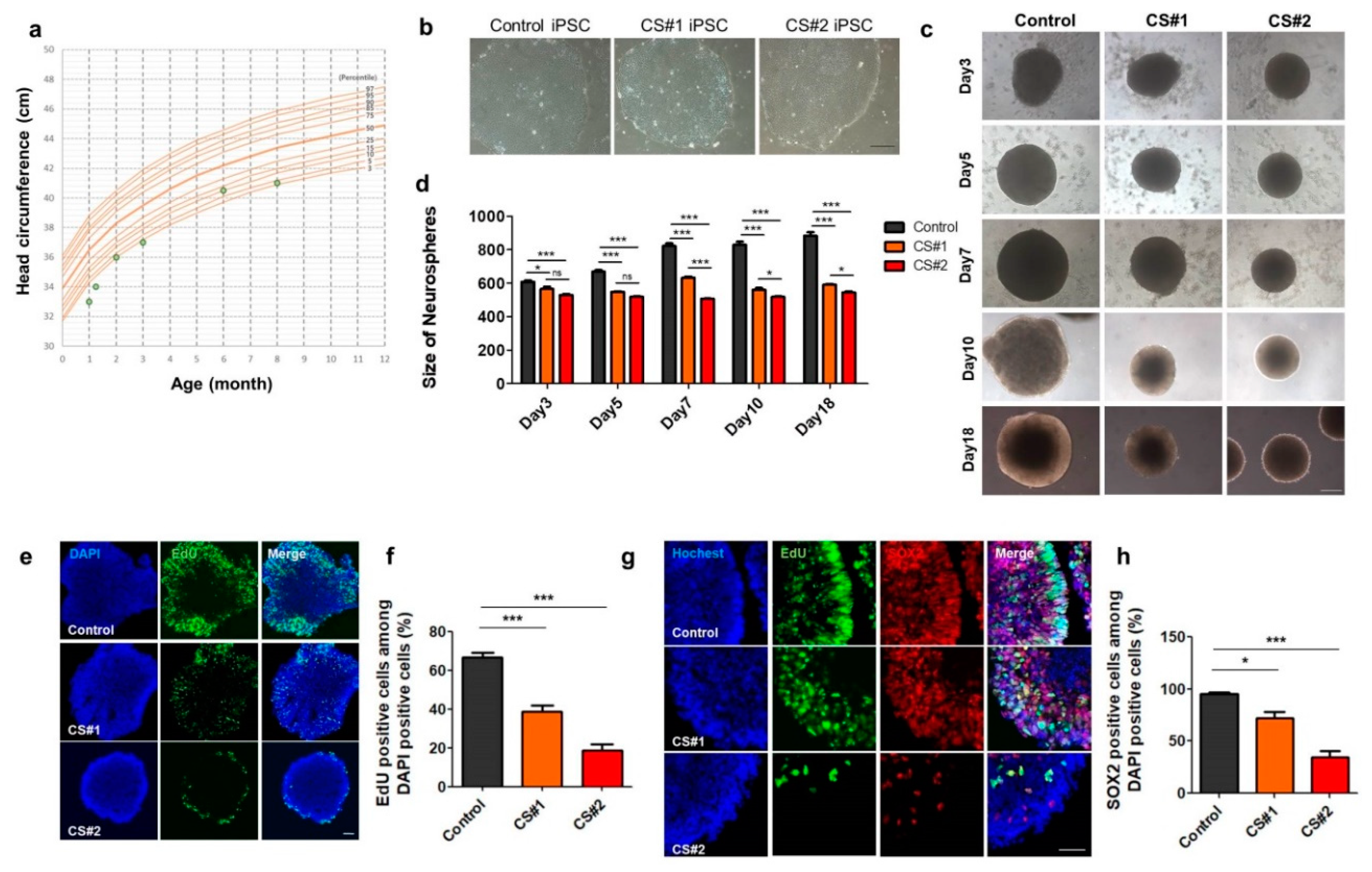 Cohen Syndrome Patient iPSC-Derived Neurospheres and